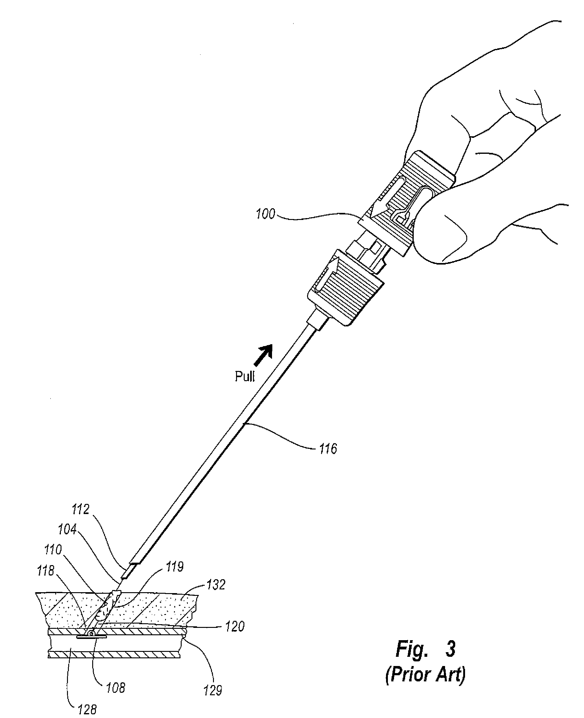 Puncture closure apparatuses, sealing plugs, and related methods