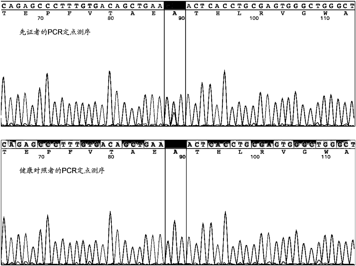 Screening kit for malignant arrhythmia, establishment method and application of animal model