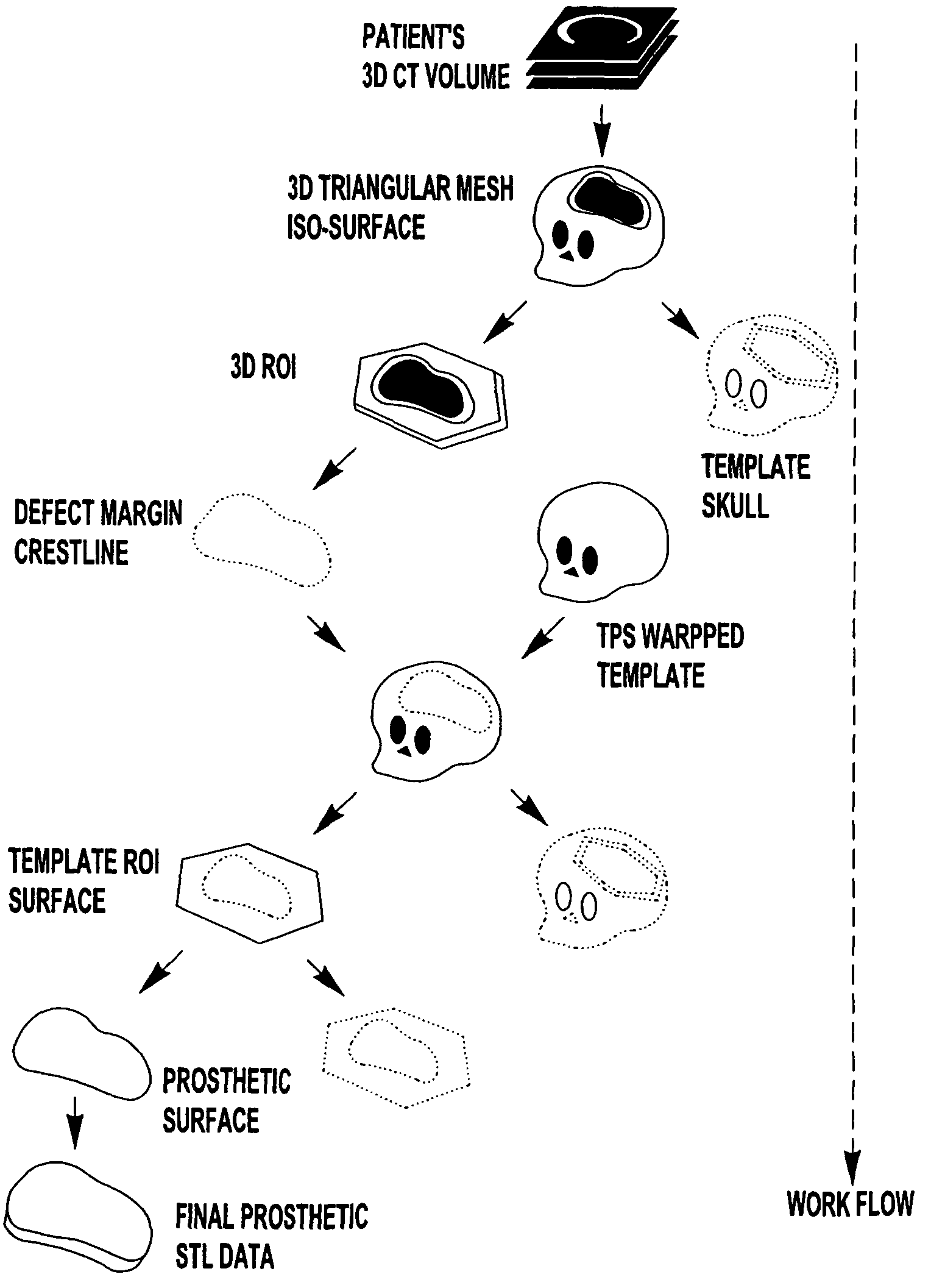Computer-aided-design of skeletal implants