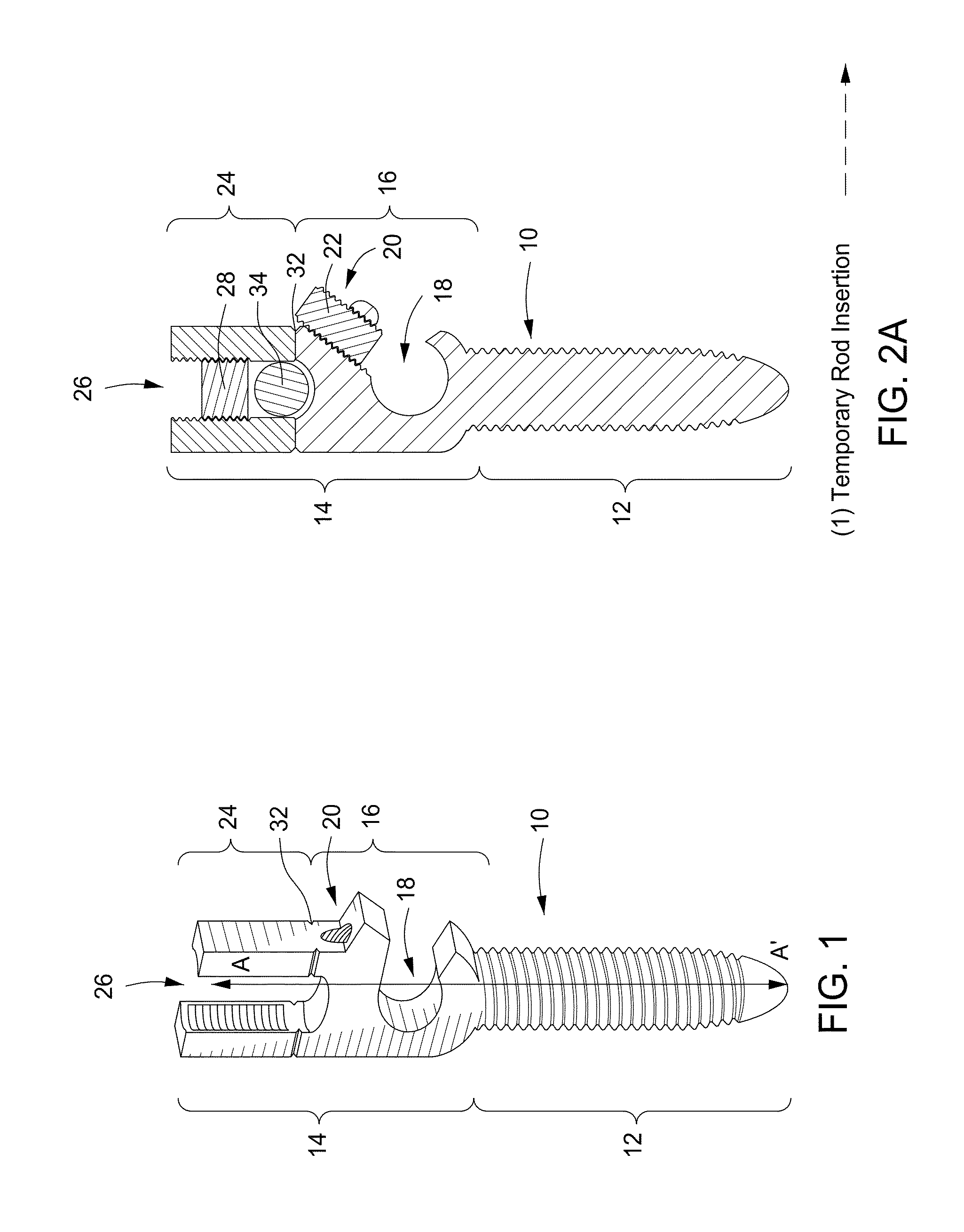 Pedicle screw having a removable rod coupling