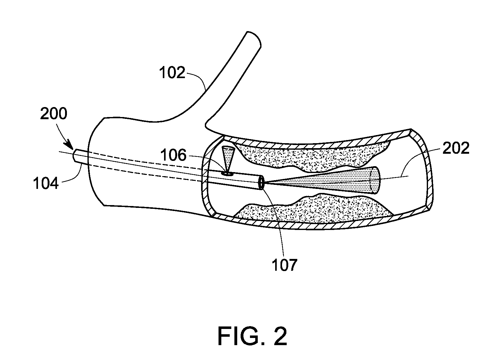 Methods and systems for intravascular imaging and flow measurement