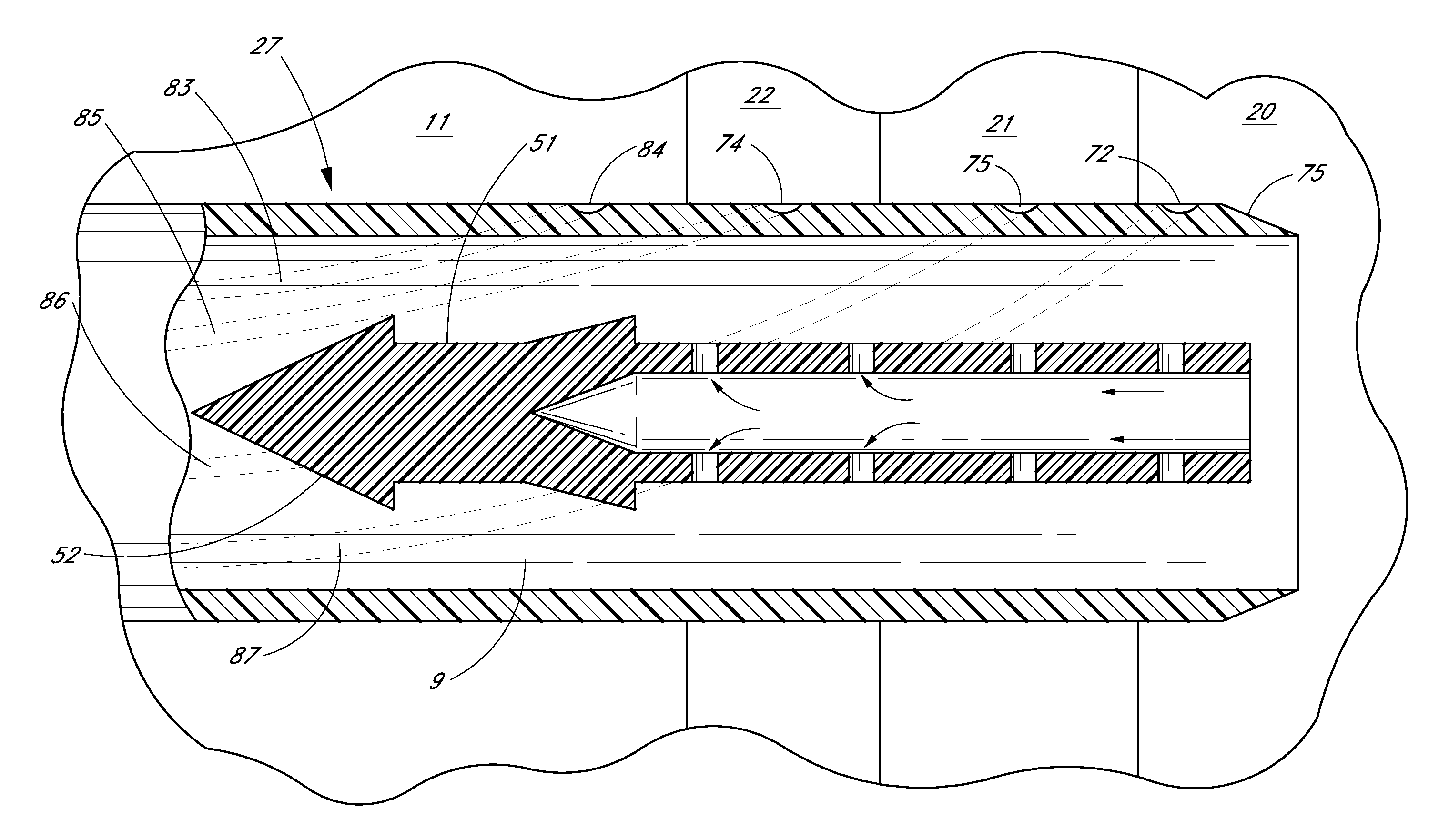 Ocular implant with anchoring mechanism and multiple outlets