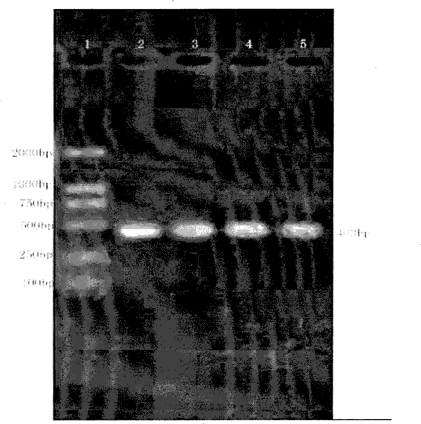 Staphylokinase and expression vector thereof