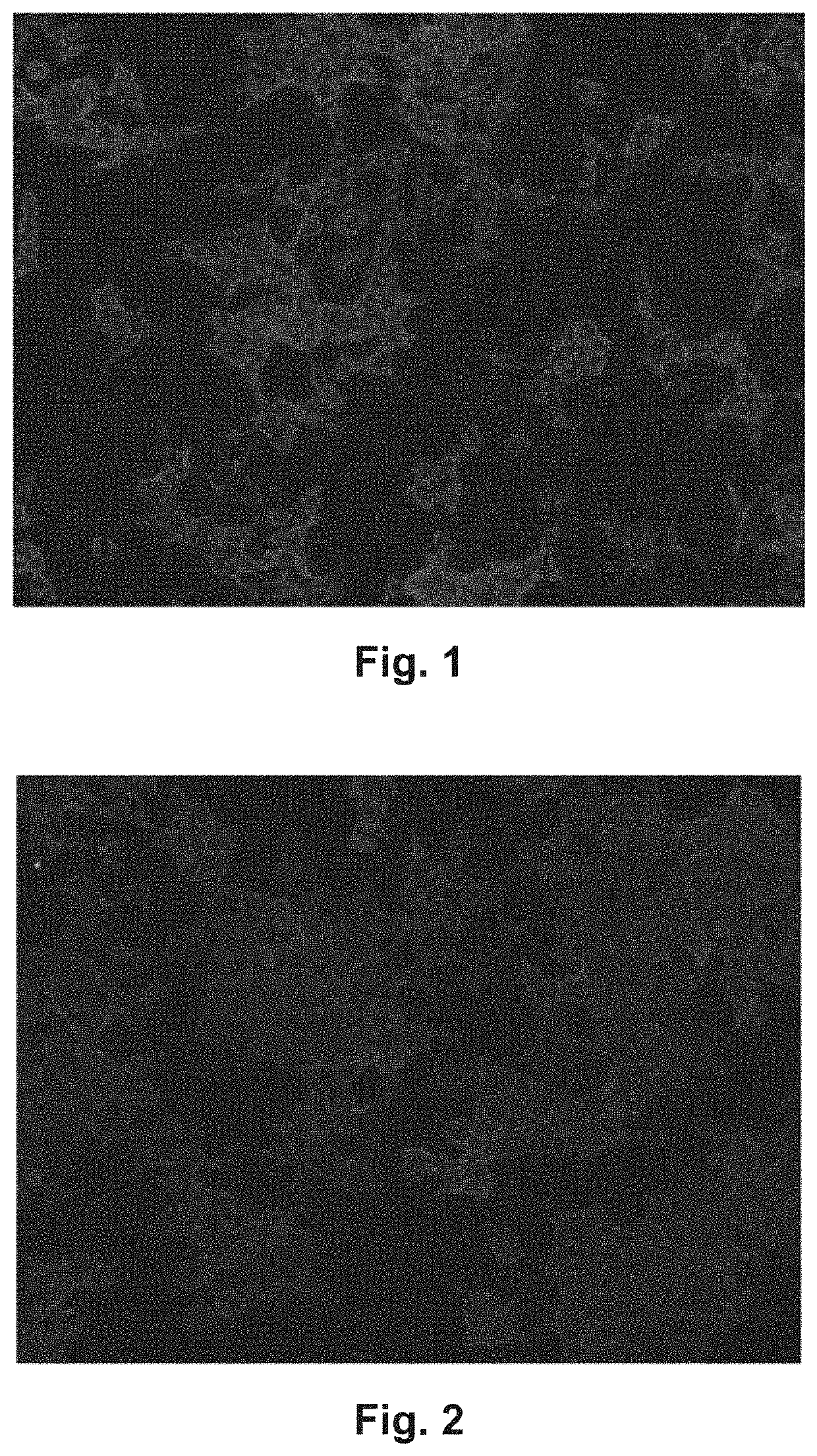 Method and reagents for diagnosing Membranous Nephropathy