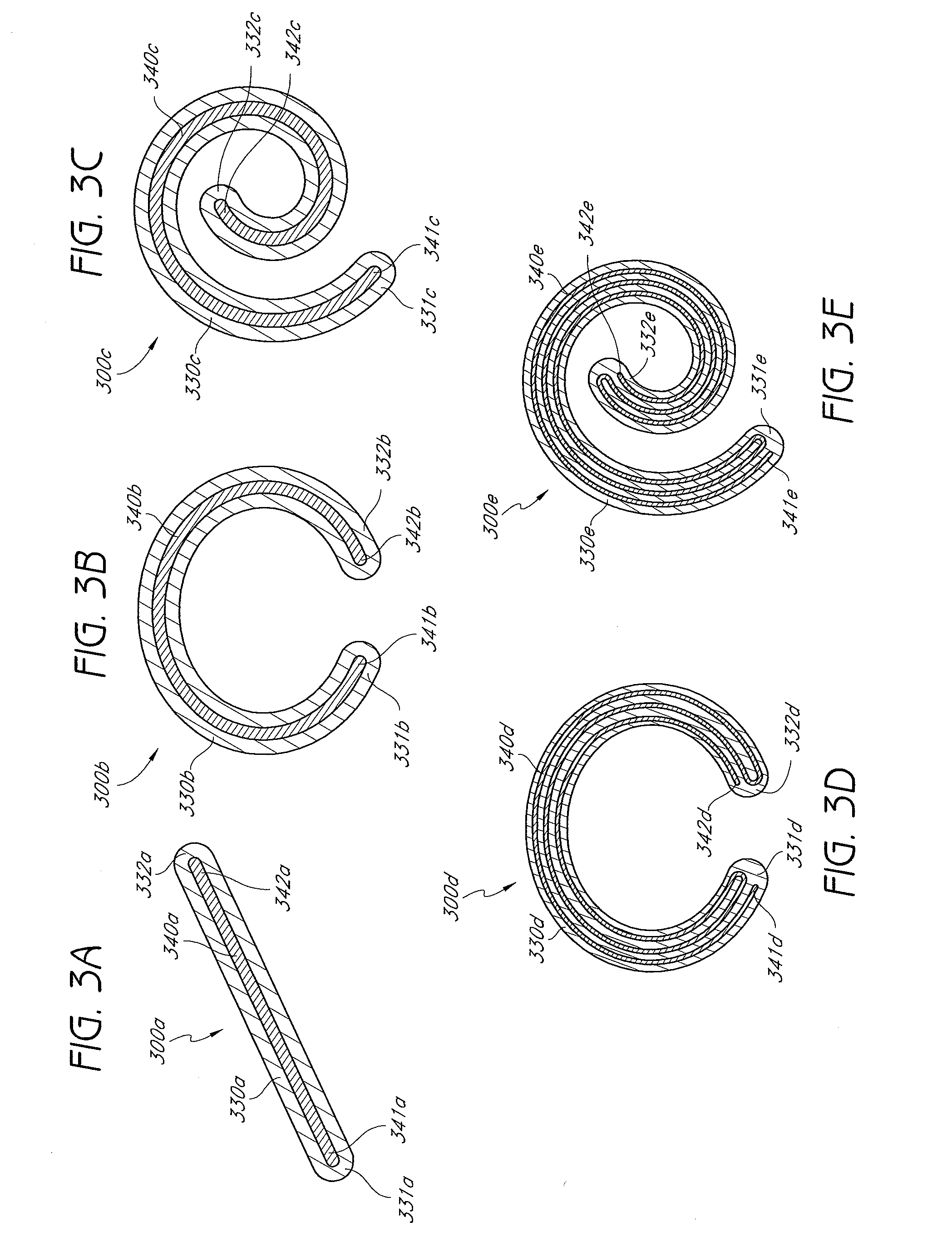 Percutaneously deliverable orthopedic joint device