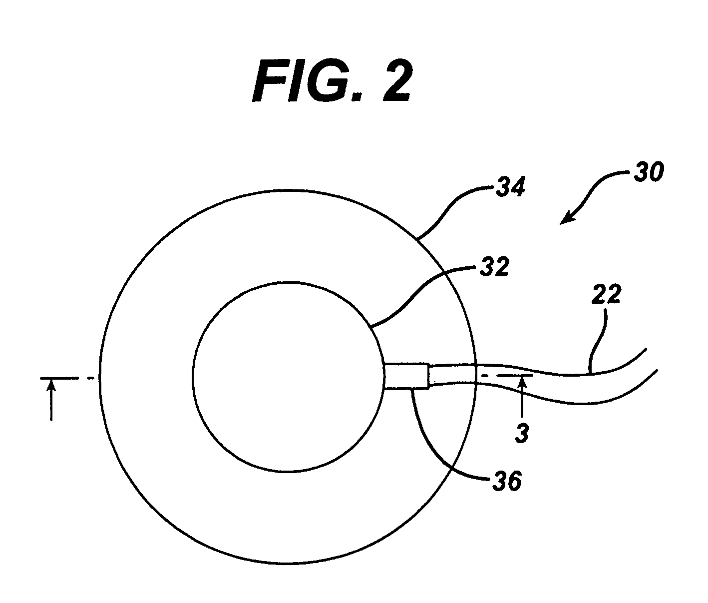 Metal bellows position feedback for hydraulic control of an adjustable gastric band