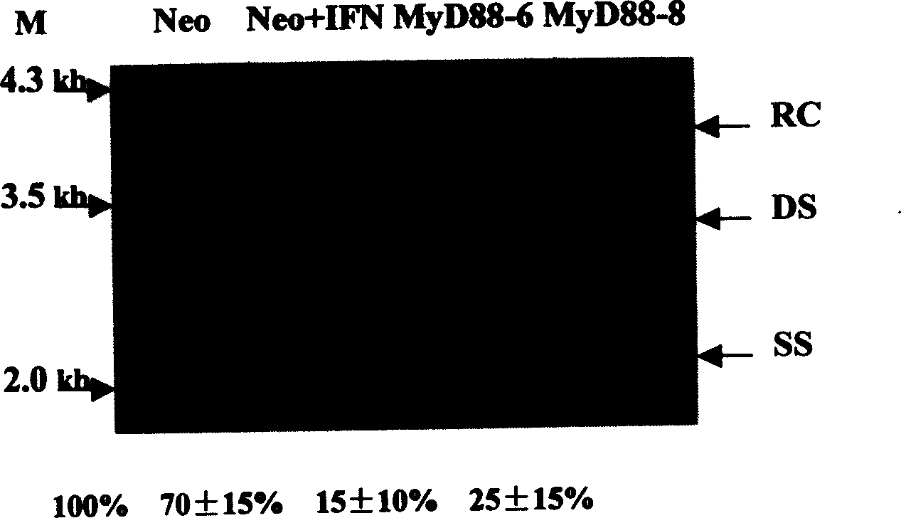 Usage of differentiation protein of medullary cell MyD88 in preparing medicinal preparation