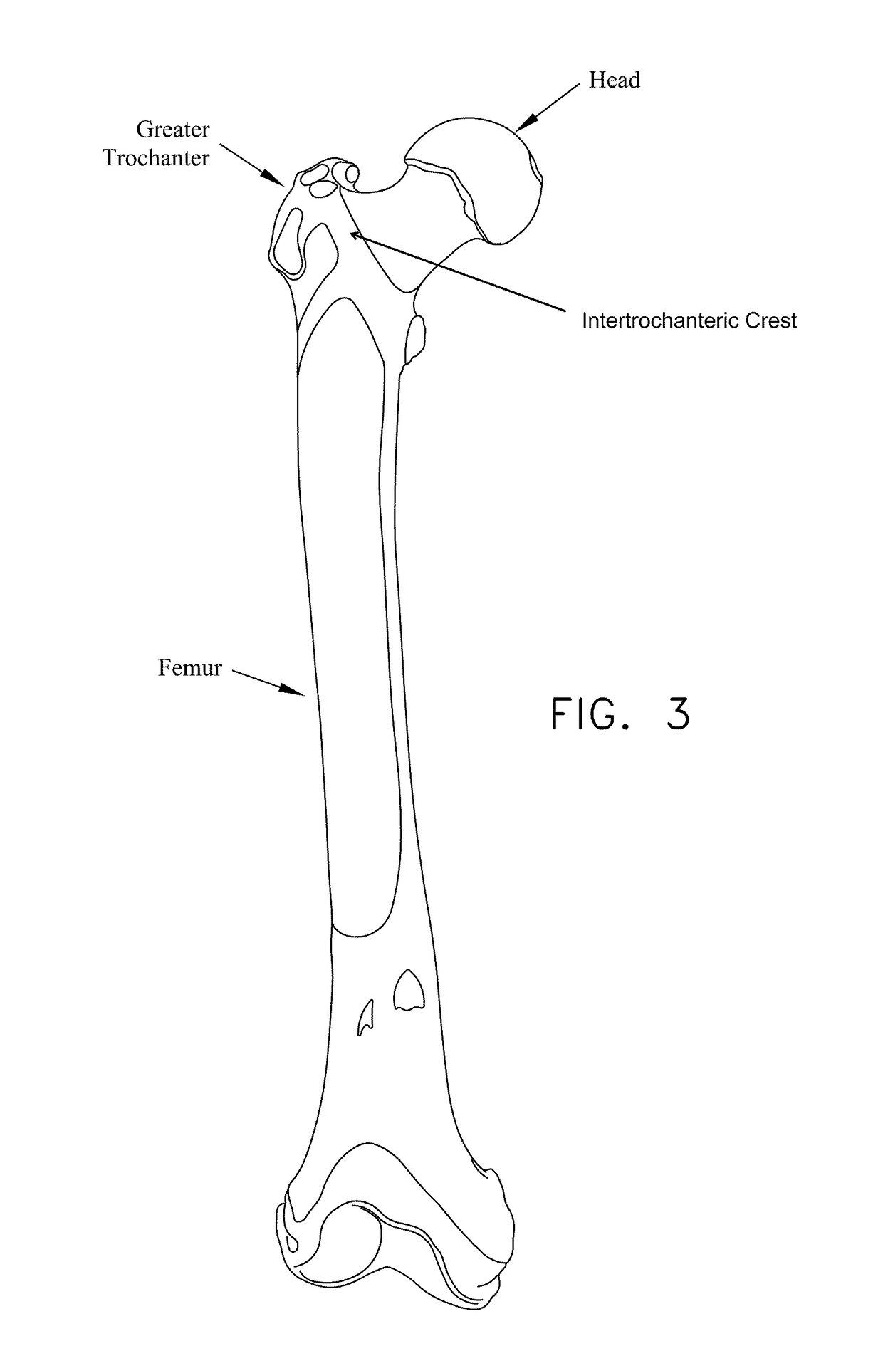 Method and apparatus for treating a hip joint, including the provision and use of a novel suture passer