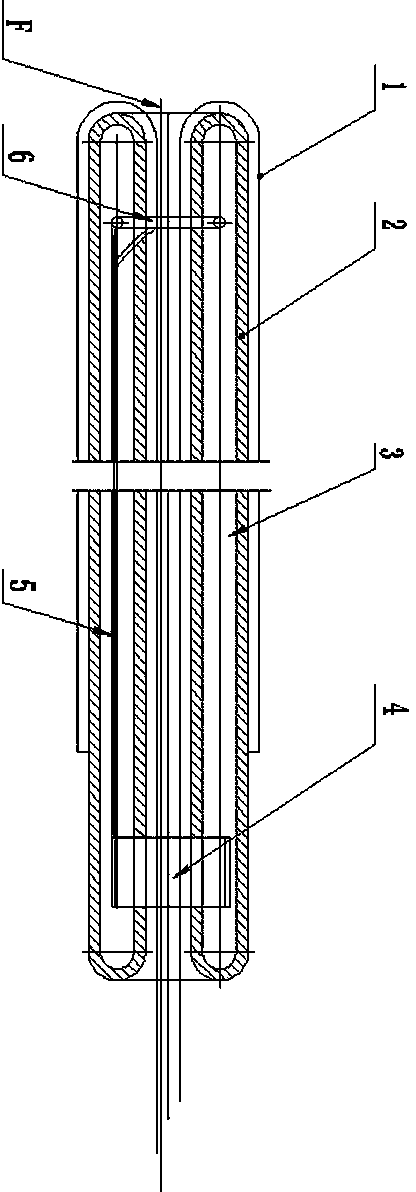 Free noninvasive endoscope pushing device