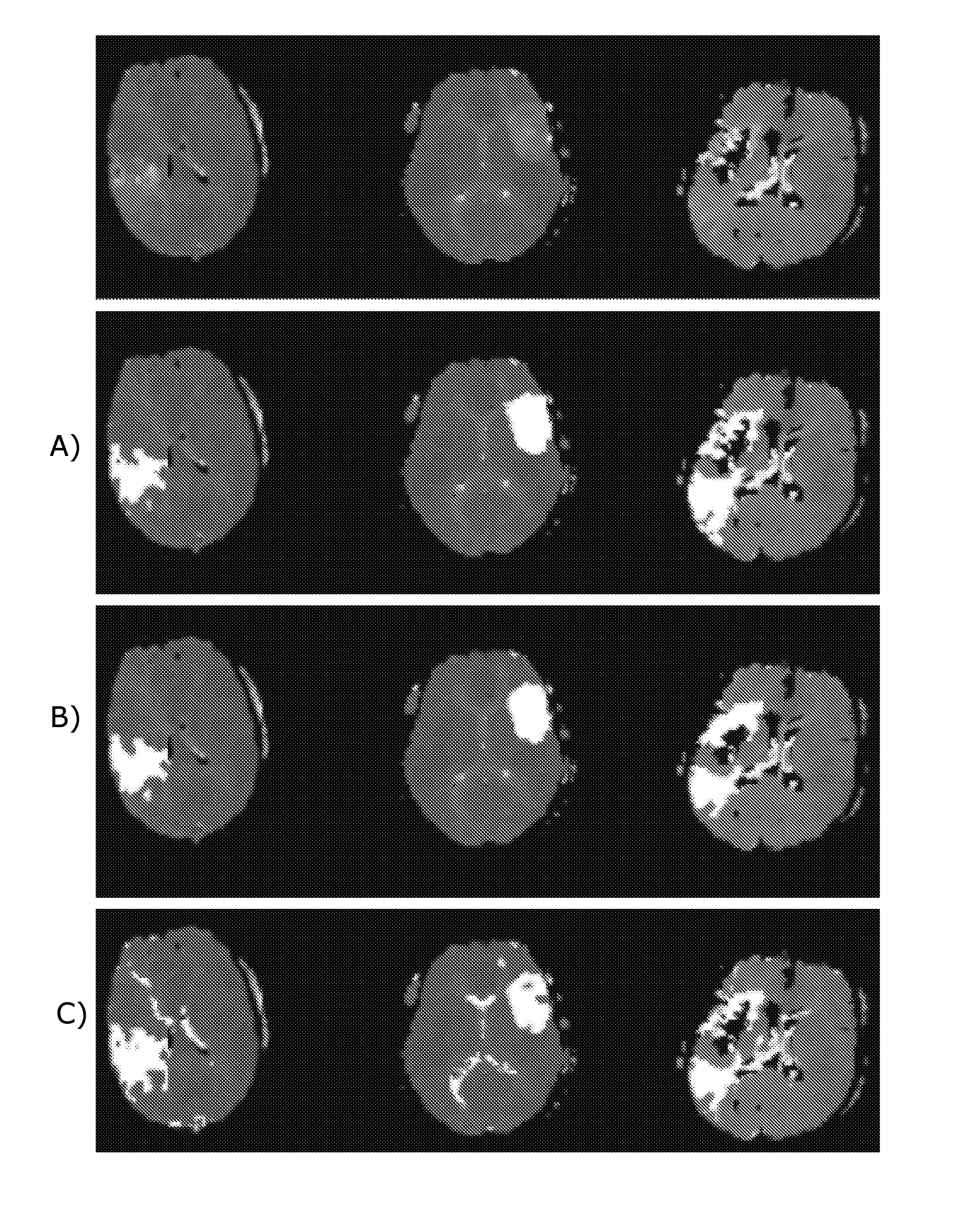 Method for delineation of tissue lesions