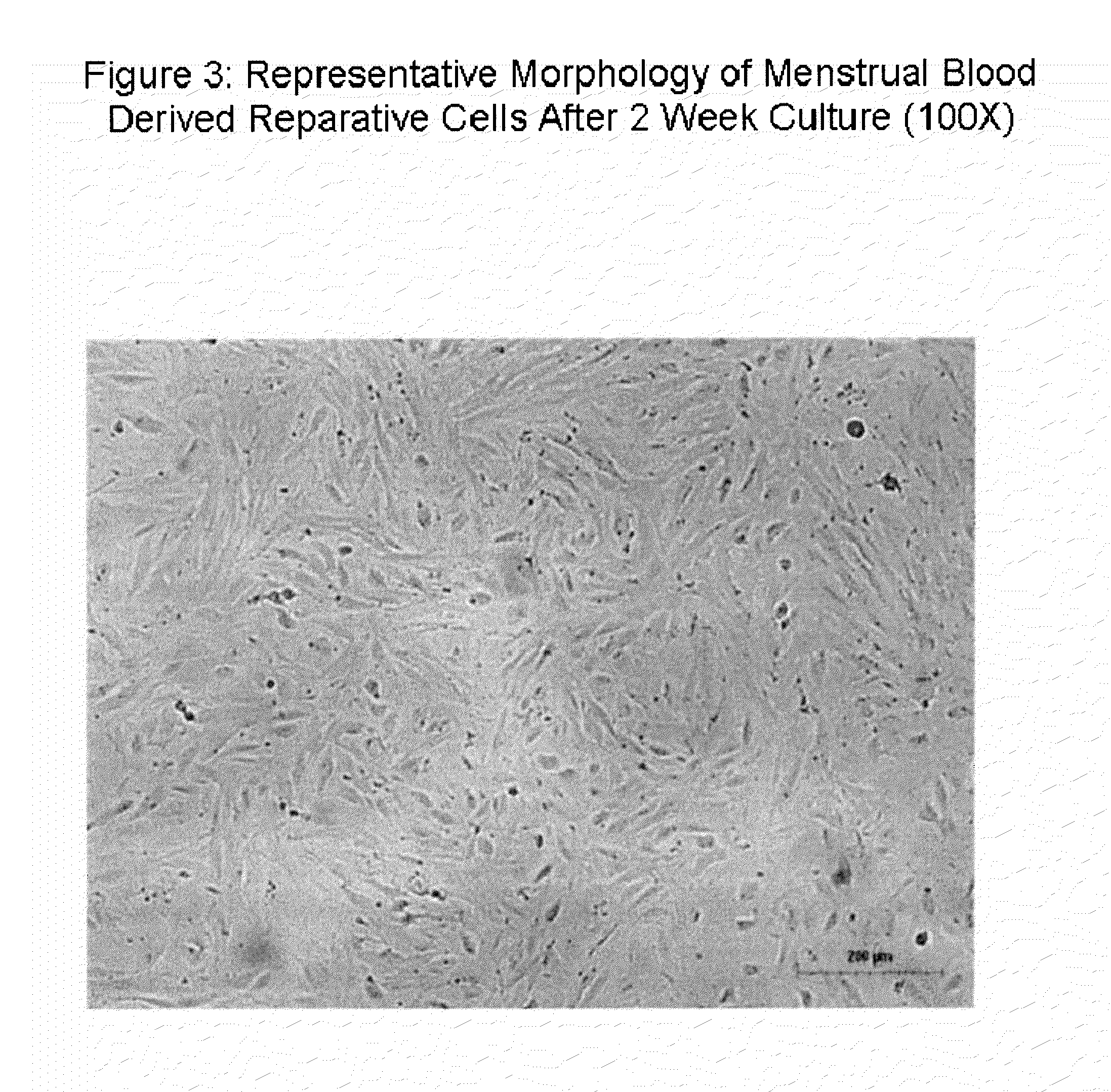 Endometrial stem cells and methods of making and using same