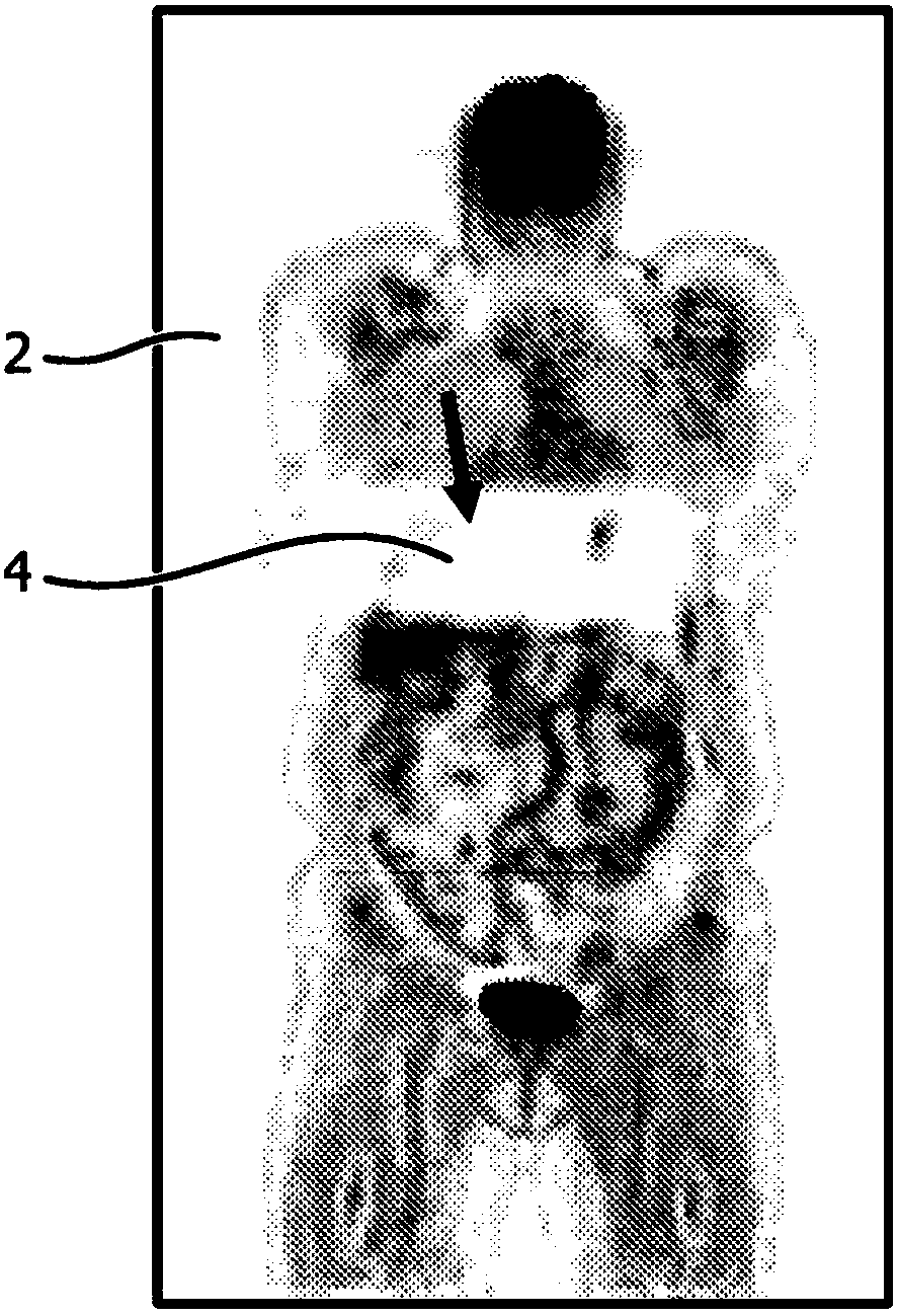 Apparatus and method for fast scatter estimation in pet reconstruction