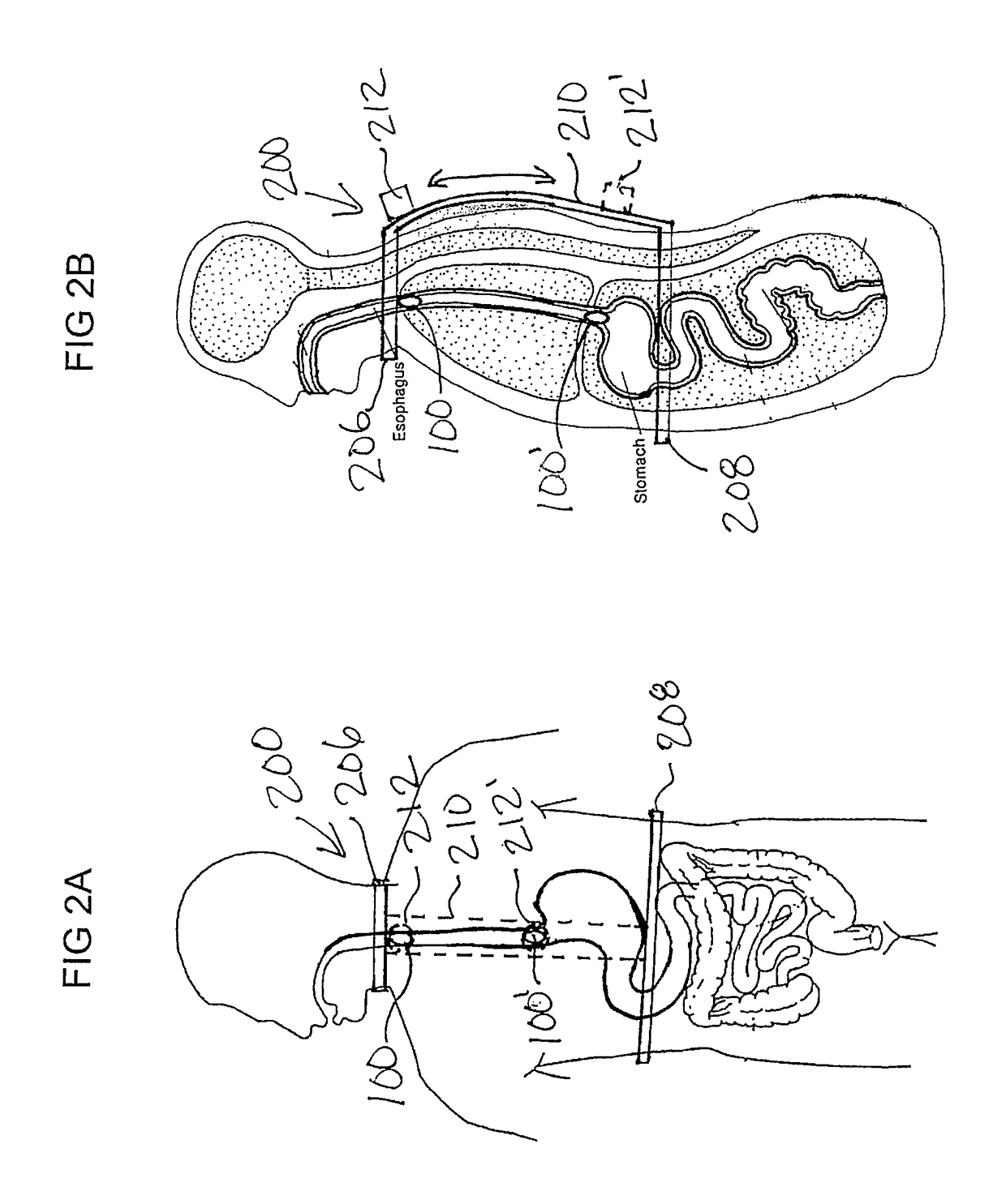 Apparatus and methods for capsule endoscopy of the esophagus