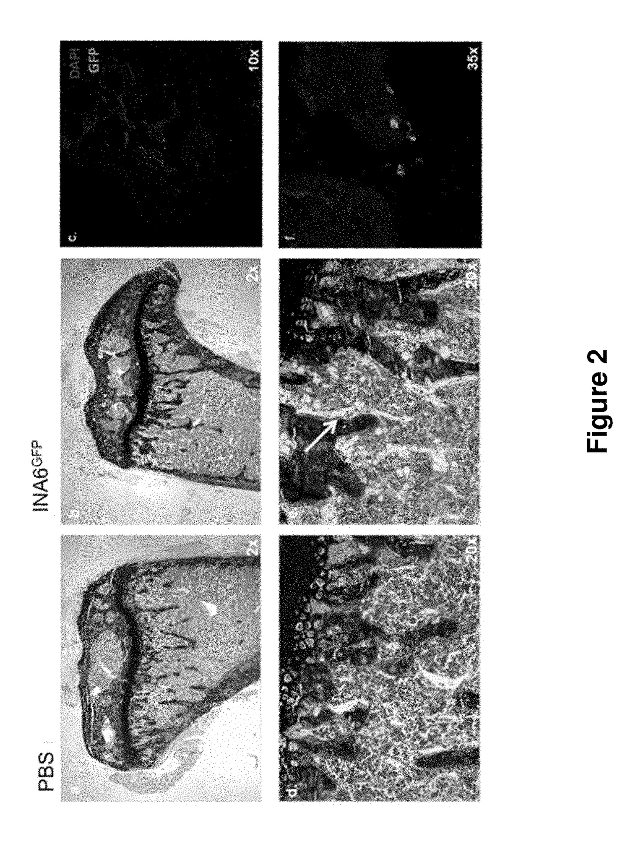 Genetically modified non-human animals and methods of use thereof