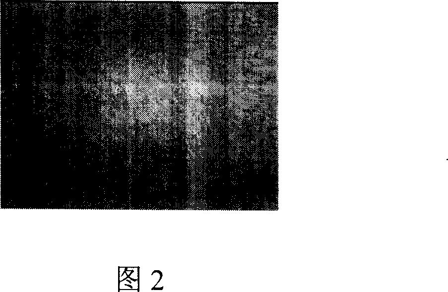 Preparation method of tissue engineering bone cartilage compound and its application