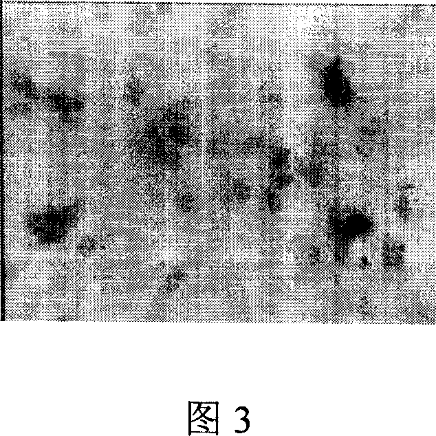 Preparation method of tissue engineering bone cartilage compound and its application