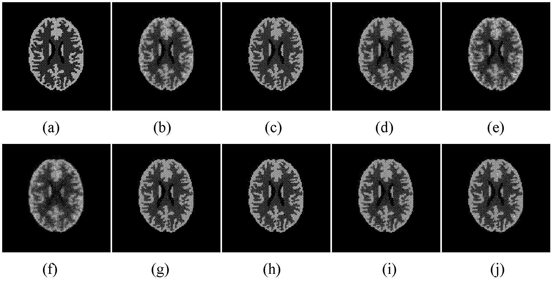 Maximum posteriori reconstruction method of PET (positron emission tomography) image based on generalized entropy and MR (magnetic resonance) prior