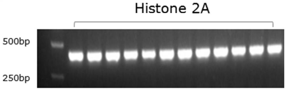 A kind of antibacterial protein and isolated nucleic acid, antibacterial drug and application