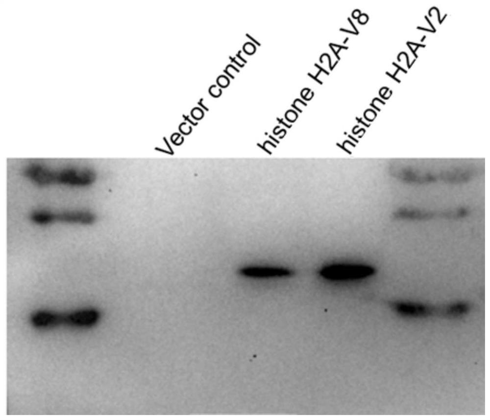 A kind of antibacterial protein and isolated nucleic acid, antibacterial drug and application