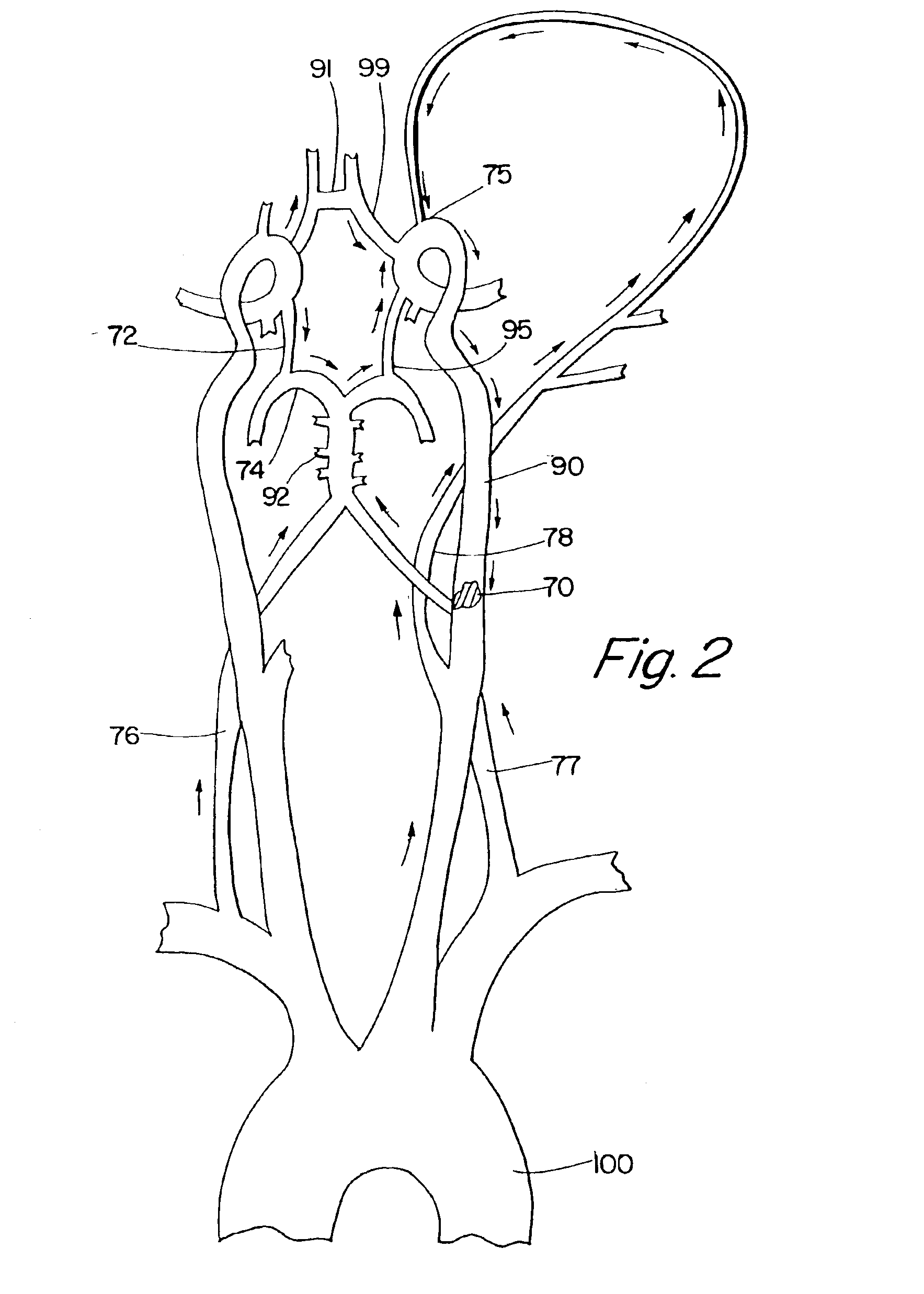 Methods for flow augmentation in patients with occlusive cerebrovascular disease