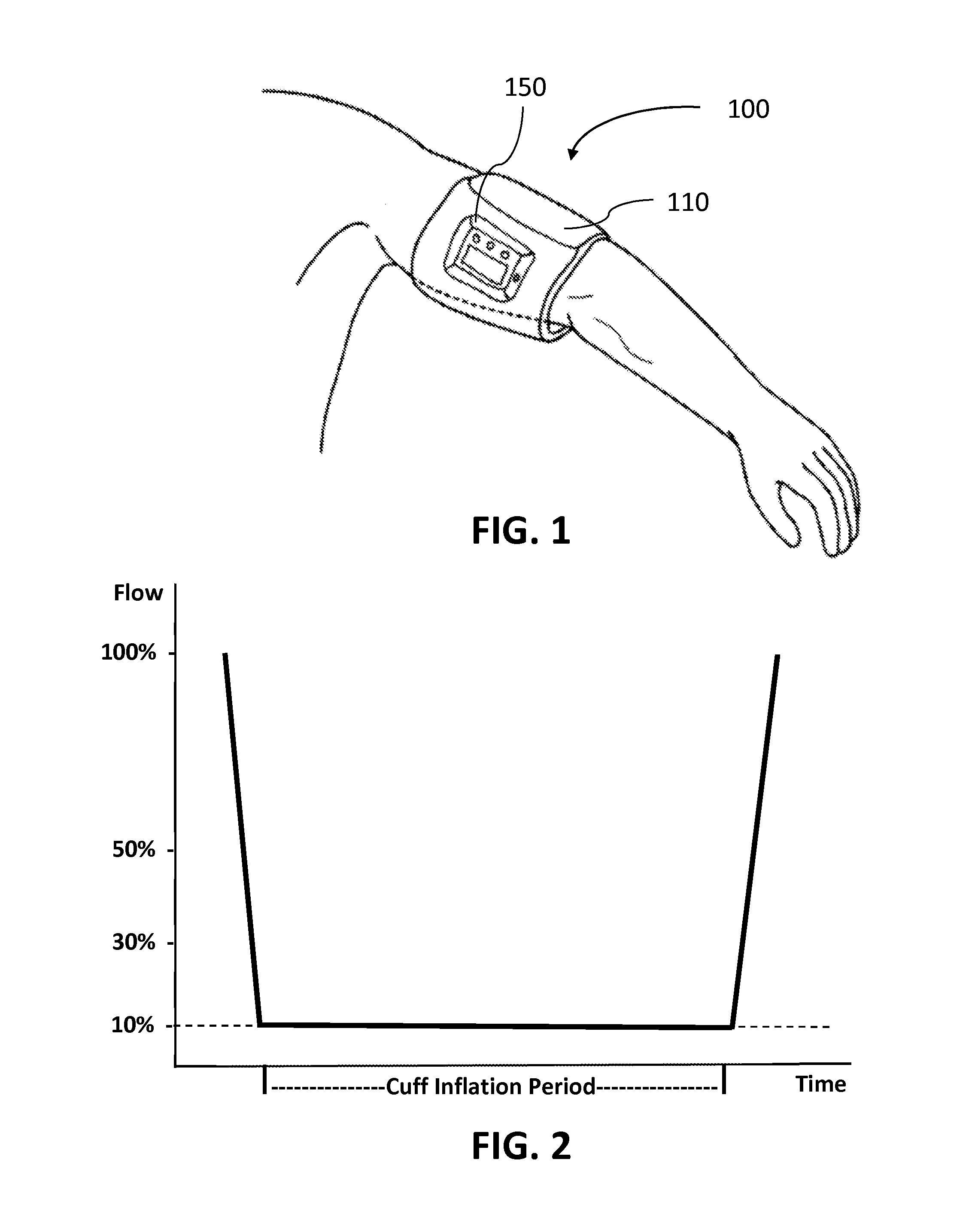 Methods and devices for remote ischemic conditioning via partial limb occlusion