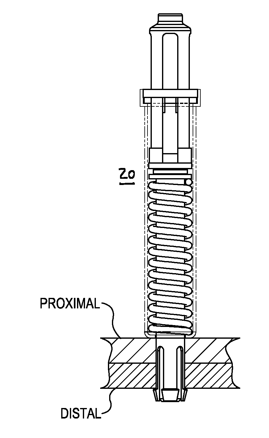 Biased blind side temporary fasteners, systems and methods