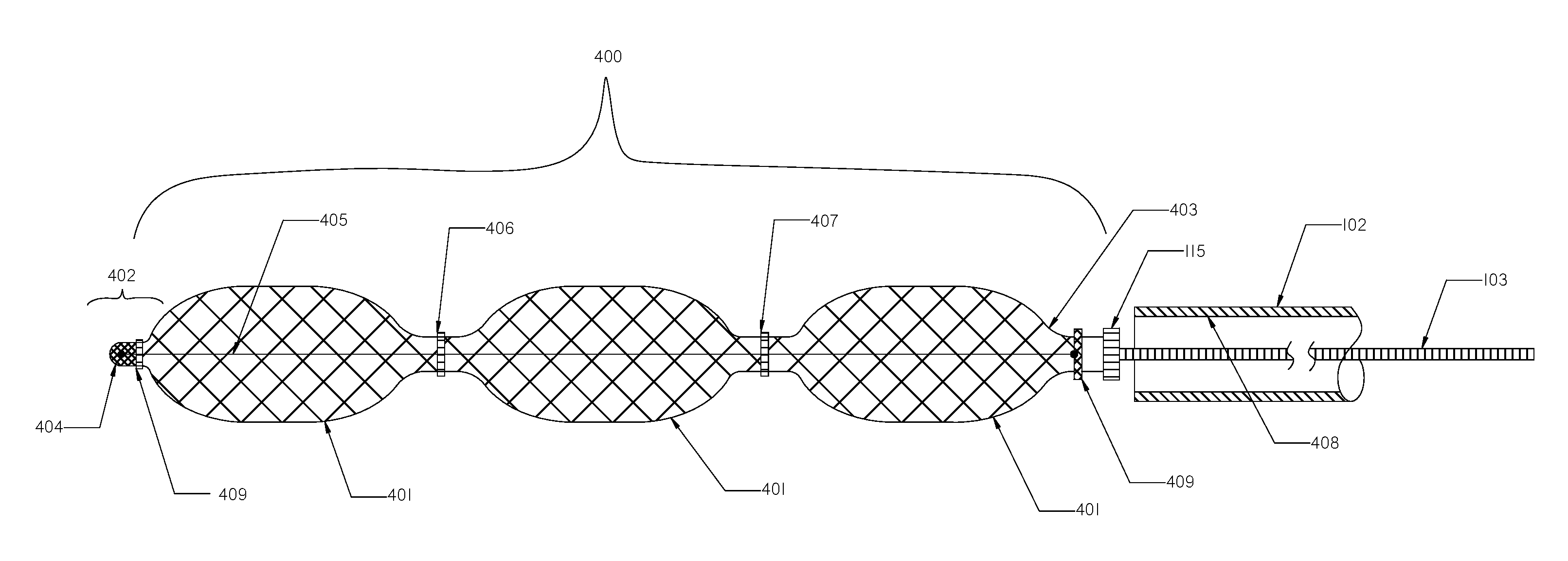 Devices and Methods for Treatment of Endovascular and Non-Endovascular Defects in Humans Using Occlusion Implants