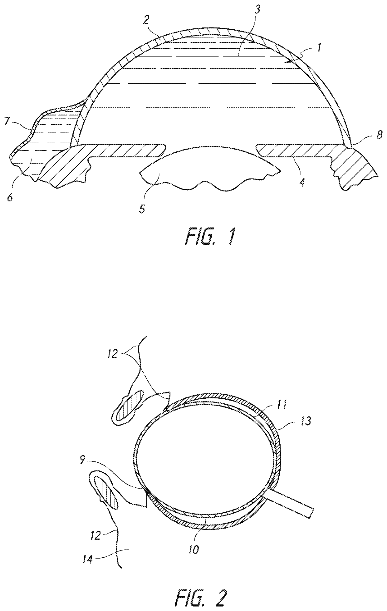 Methods for implanting intraocular shunts