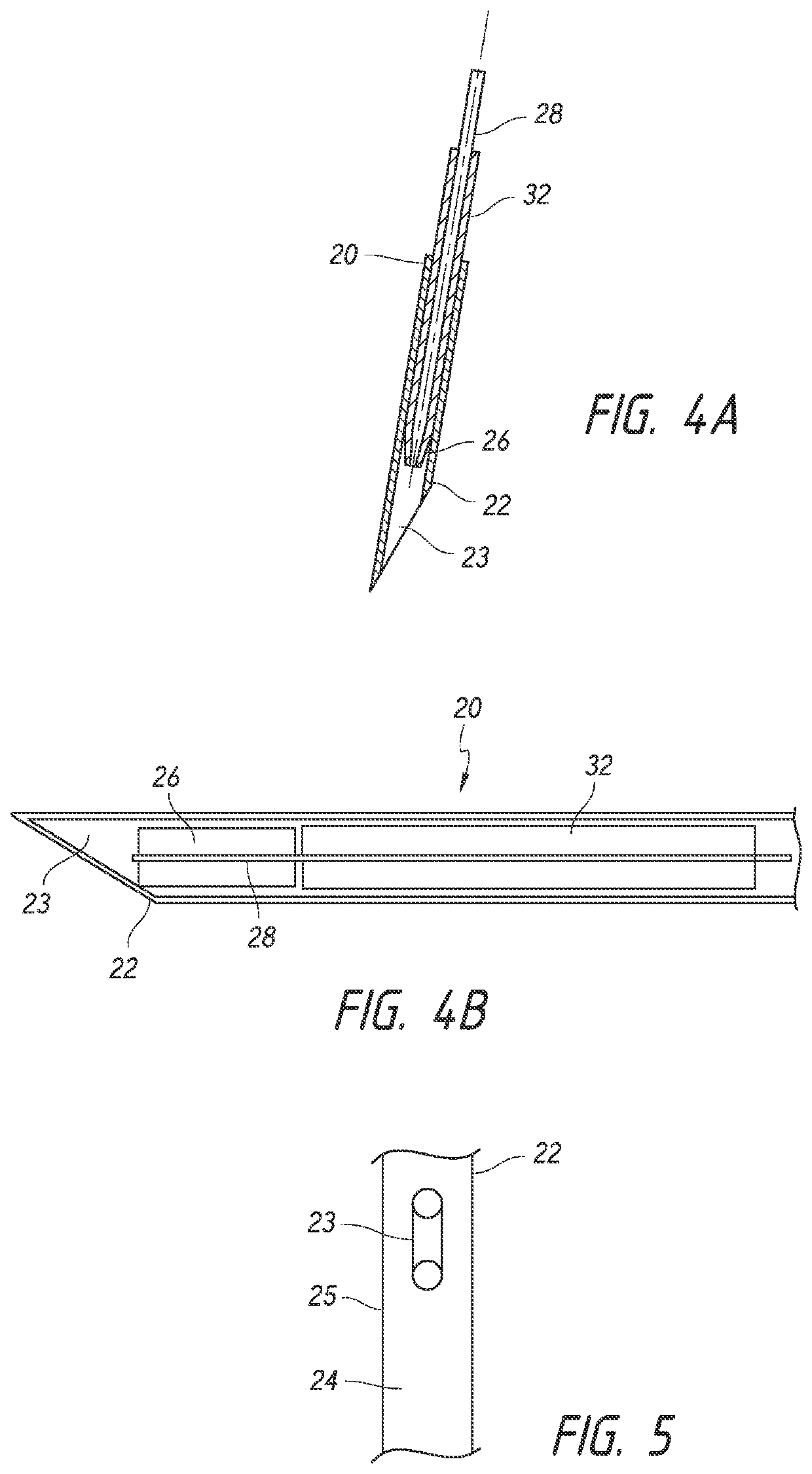 Methods for implanting intraocular shunts