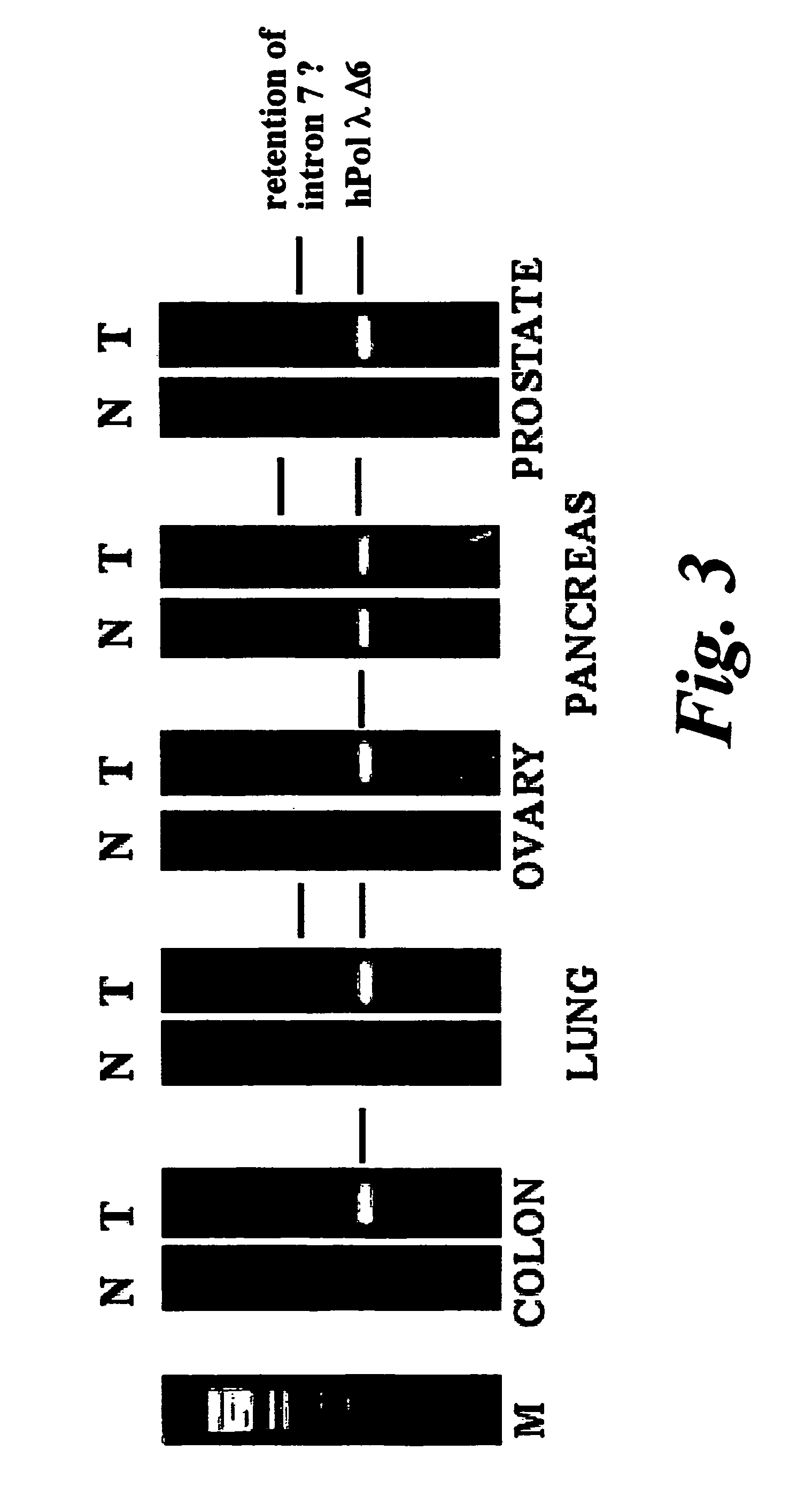 DNA polymerase lambda and uses thereof
