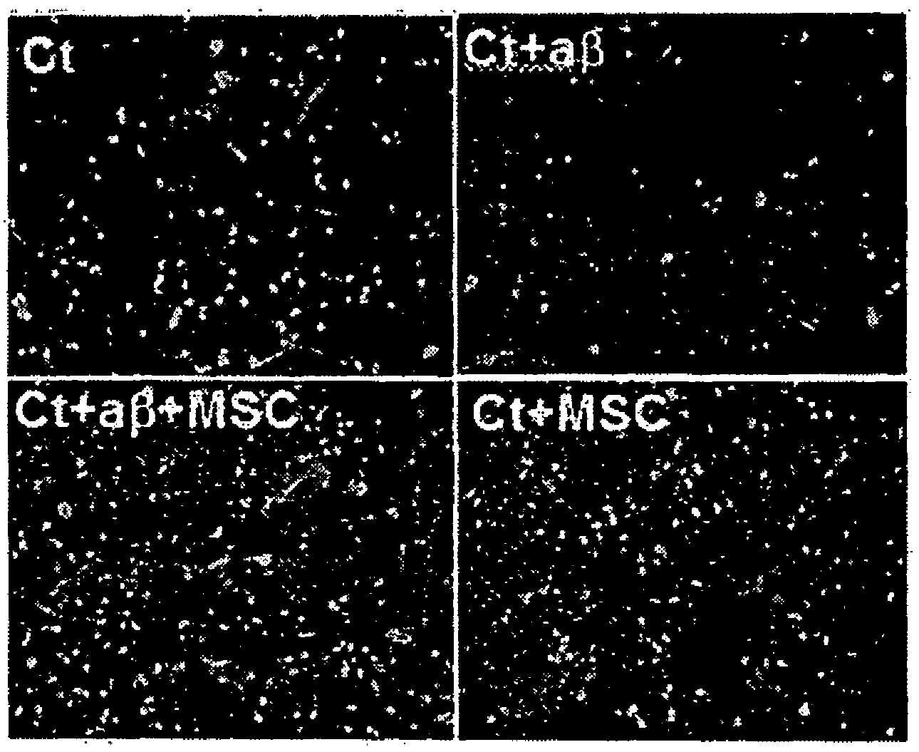 Composition comprising mesenchymal stem cells or mesenchymal stem cell culture fluid for preventing or treating neurological diseases