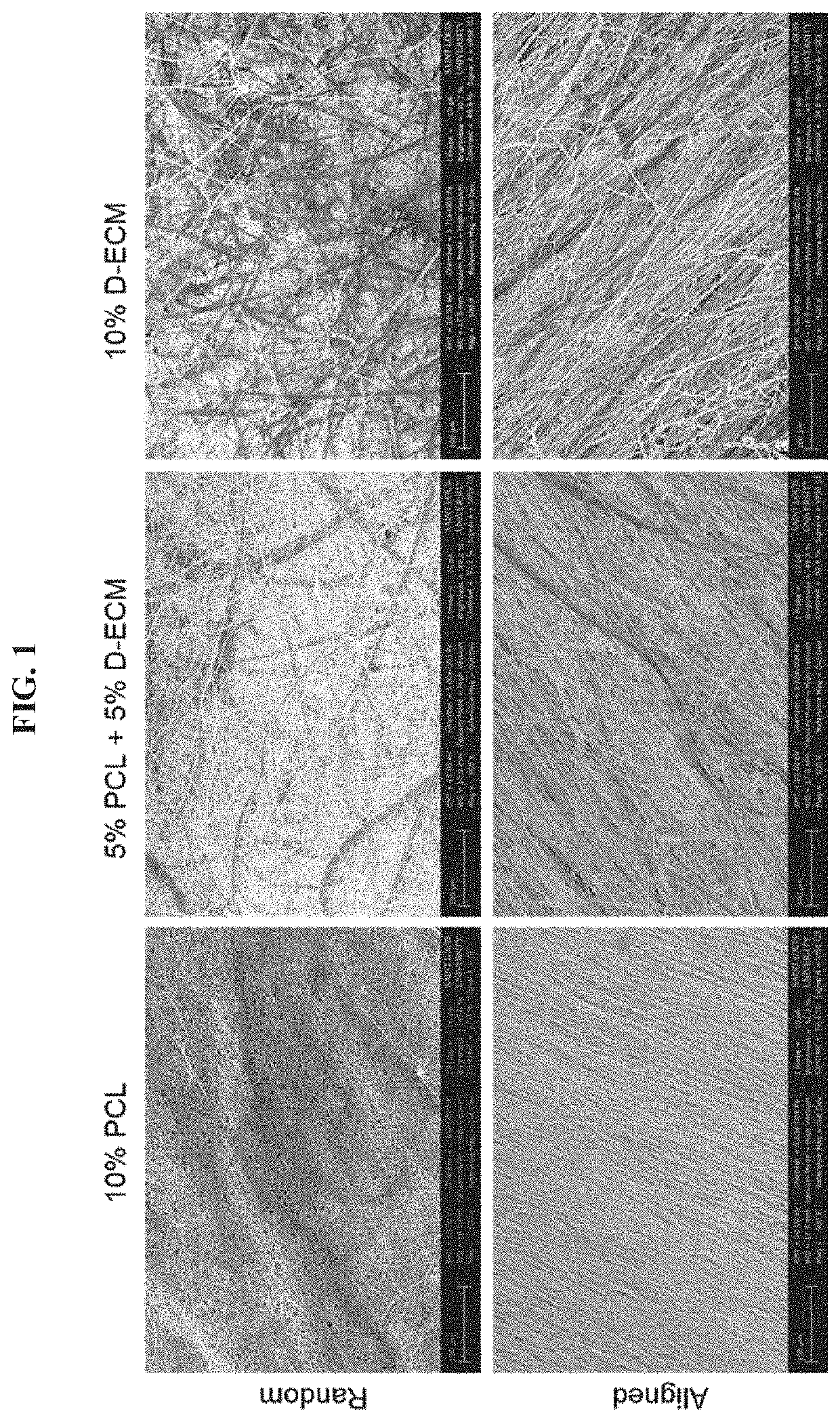 Aligned electrospun matrices of decellularized muscle for tissue regeneration