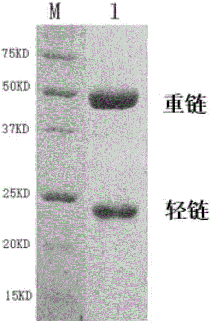 Monoclonal antibody capable of simultaneously recognizing duck hepatitis A virus 1 and duck hepatitis A virus 3, and hybridoma cell strain and application thereof