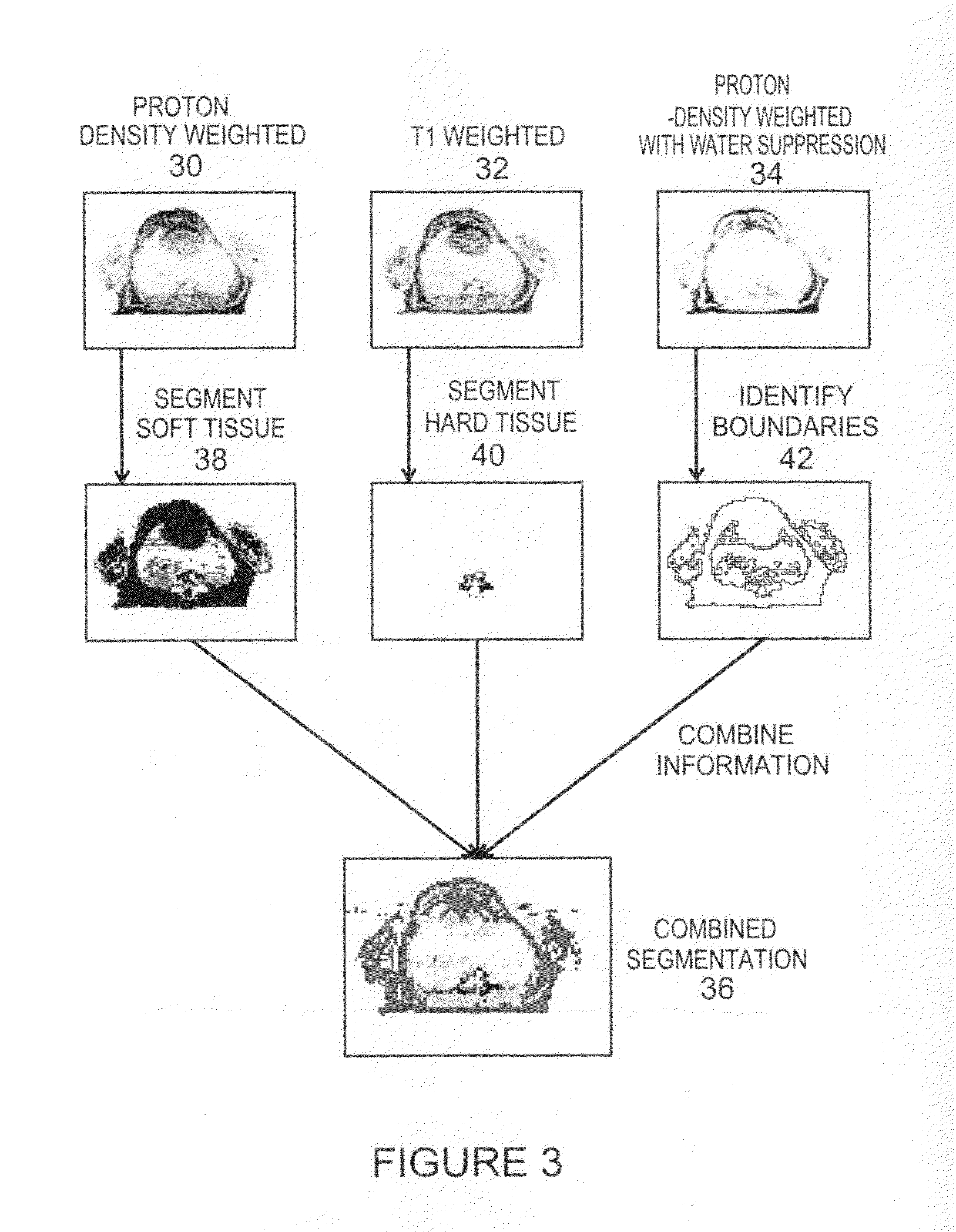 System and method for correcting attenuation in hybrid medical imaging