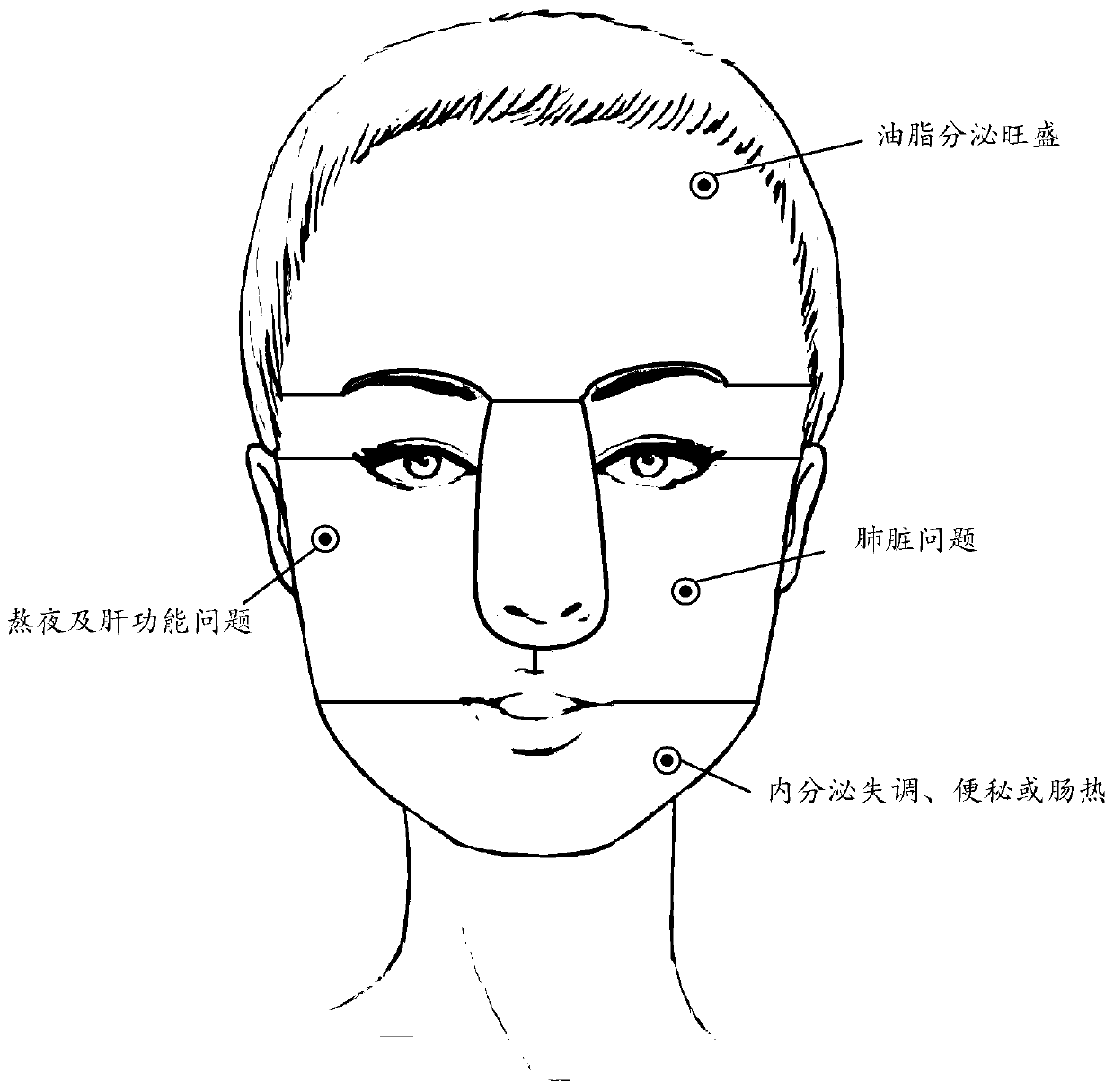 Skin problem diagnosis method based on deep learning face partitioning