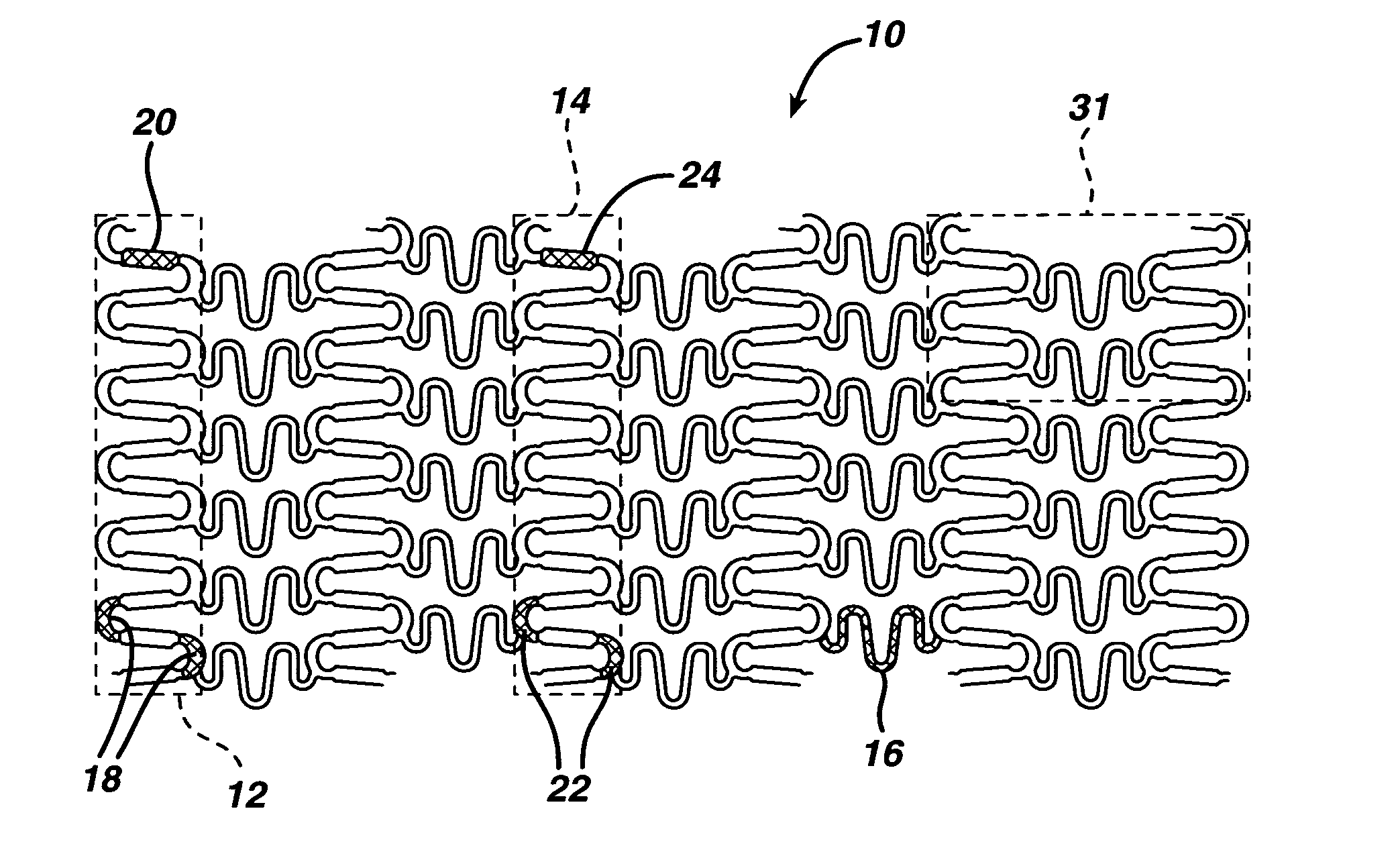 Cobalt-chromium-molybdenum fatigue resistant alloy for intravascular medical devices