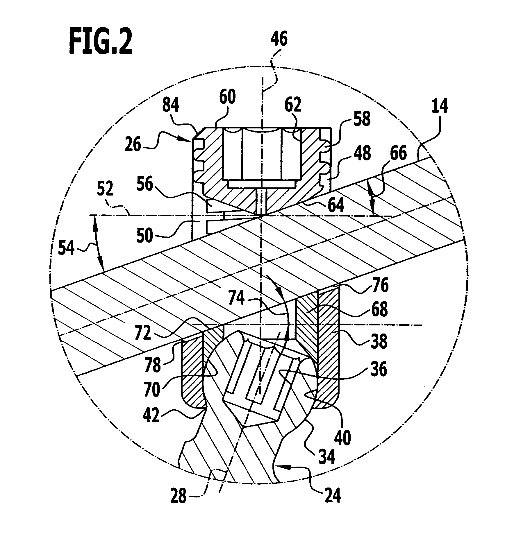 Implant system and fastening element for an implant system