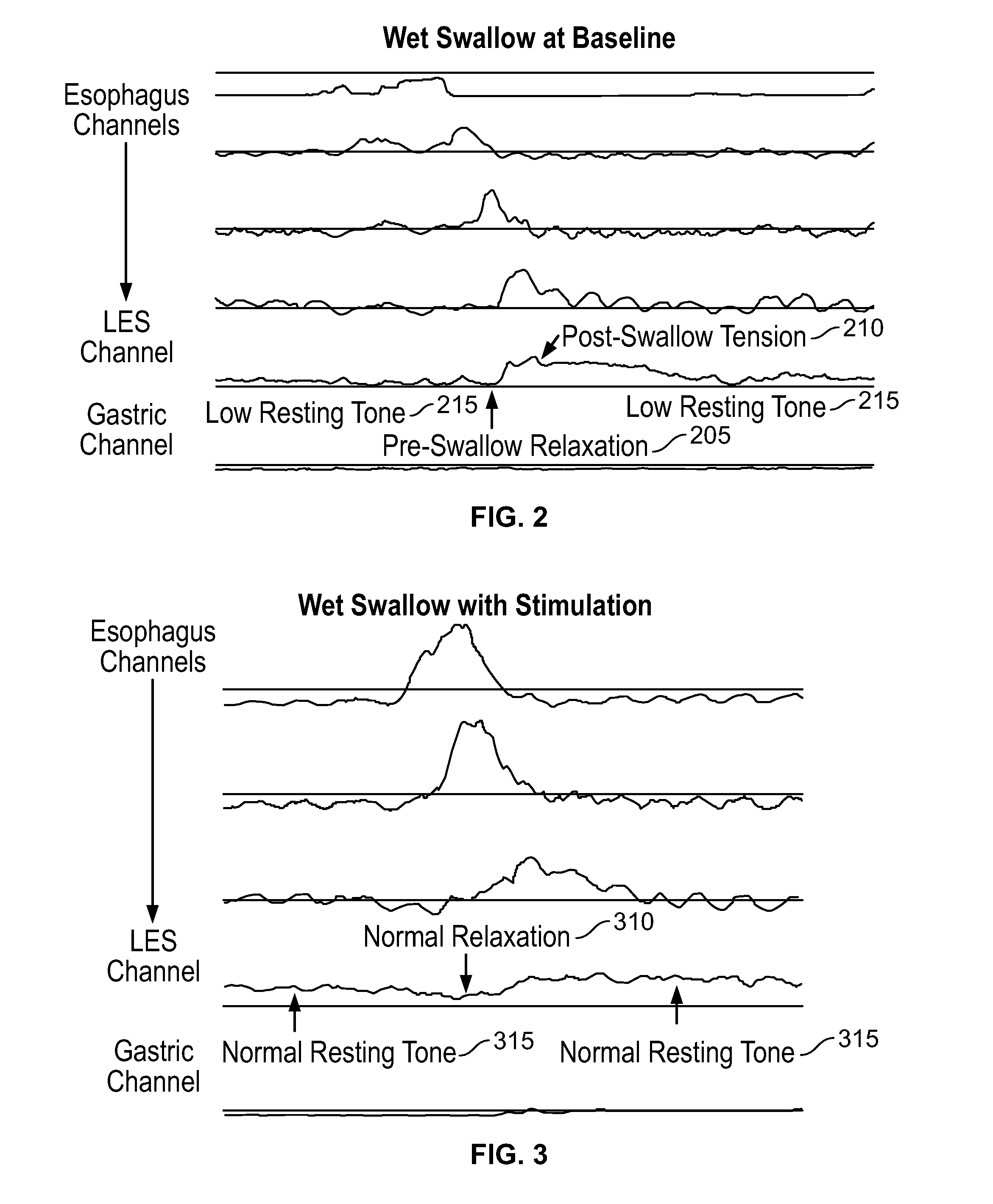 Device and Implantation System for Electrical Stimulation of Biological Systems