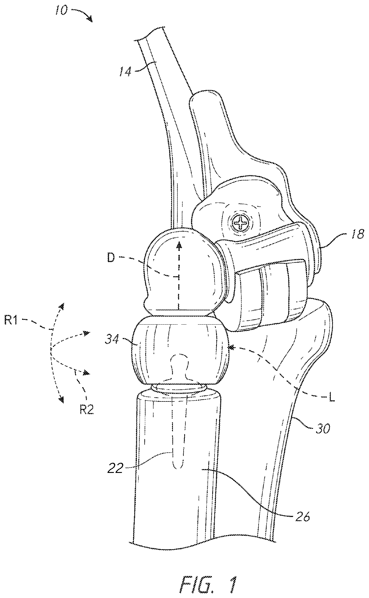 Elbow joint prostheses