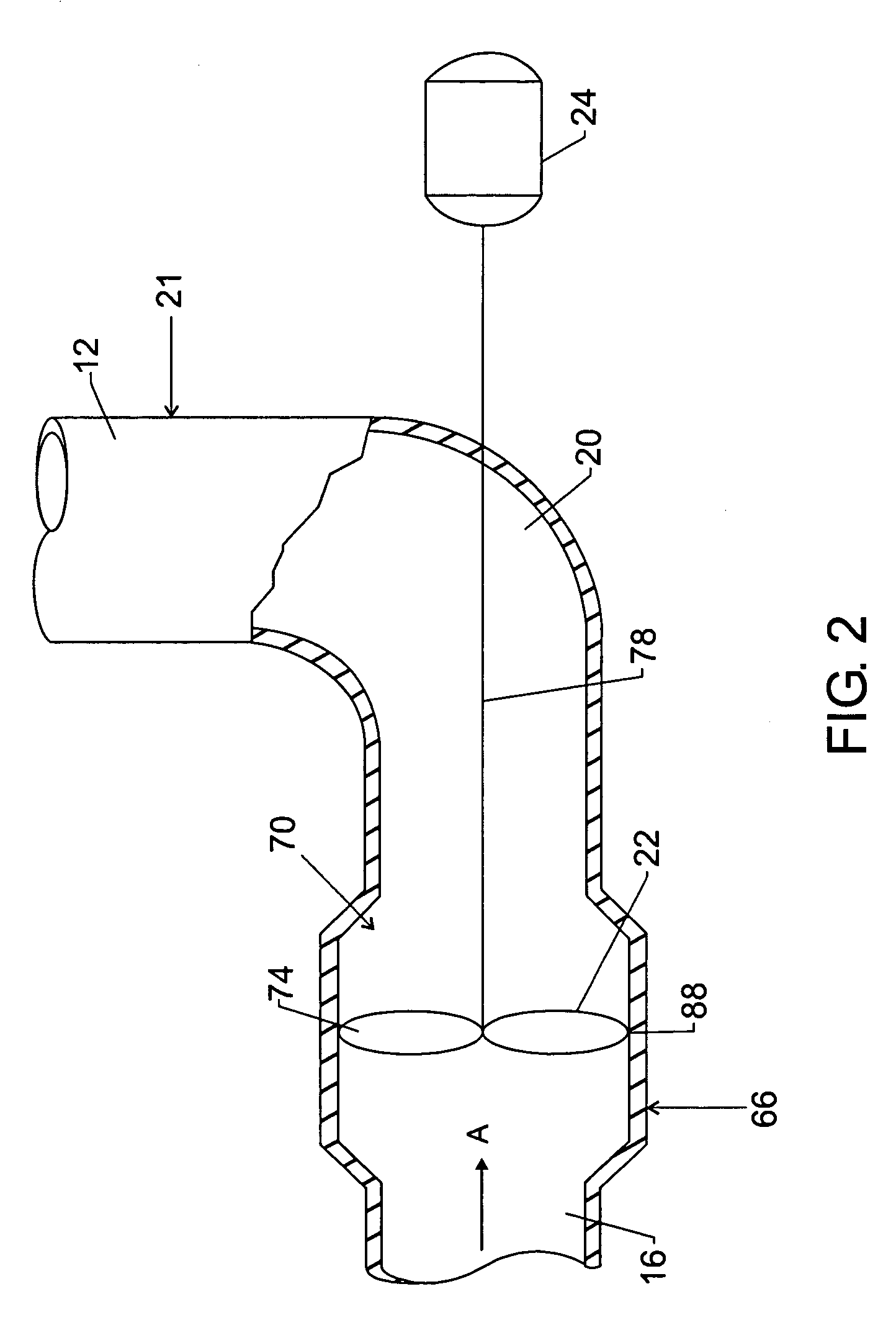 Pumping apparatus for slurry polymerization in loop reactors