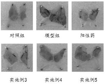 Chenopodium quinoa willd extract and application thereof in preparation of medicine and food for preventing gastric mucosal lesion