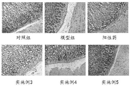 Chenopodium quinoa willd extract and application thereof in preparation of medicine and food for preventing gastric mucosal lesion