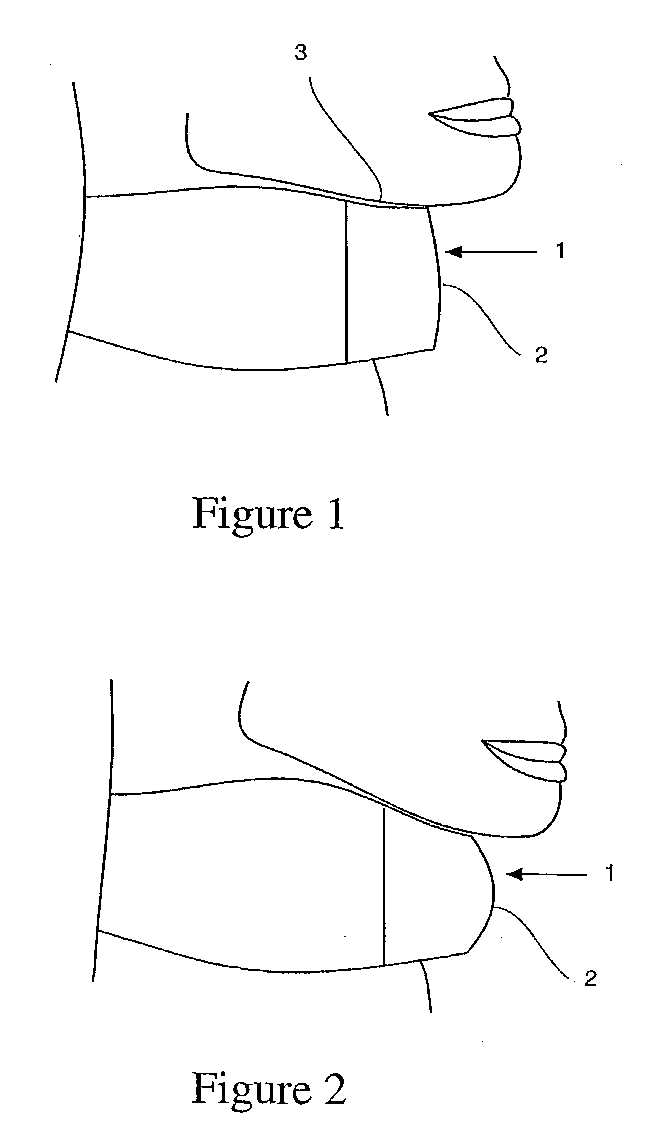 Apparatus and method for exercising and monitoring the performance of the upper flexor muscles of the neck