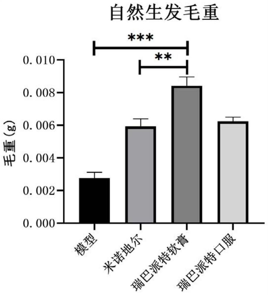 Anti-hair loss and hair growth uses of rebamipide