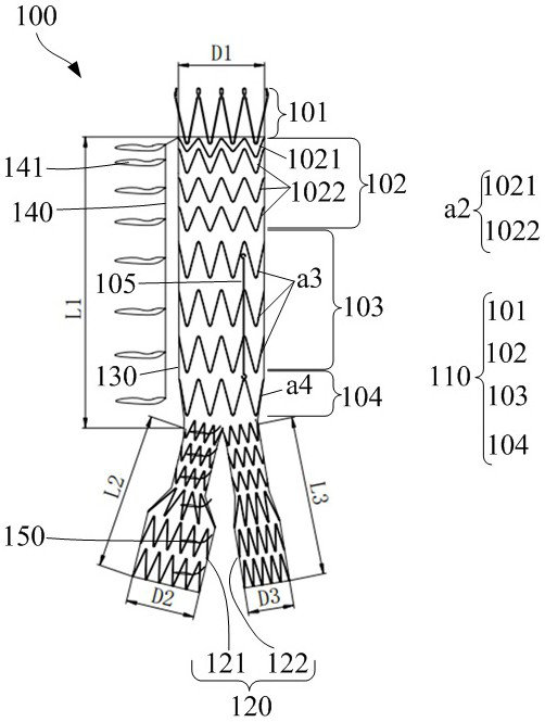 Stent Graft