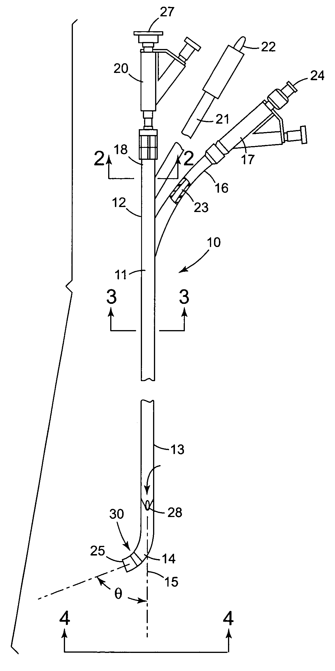 System and method for accessing the coronary sinus