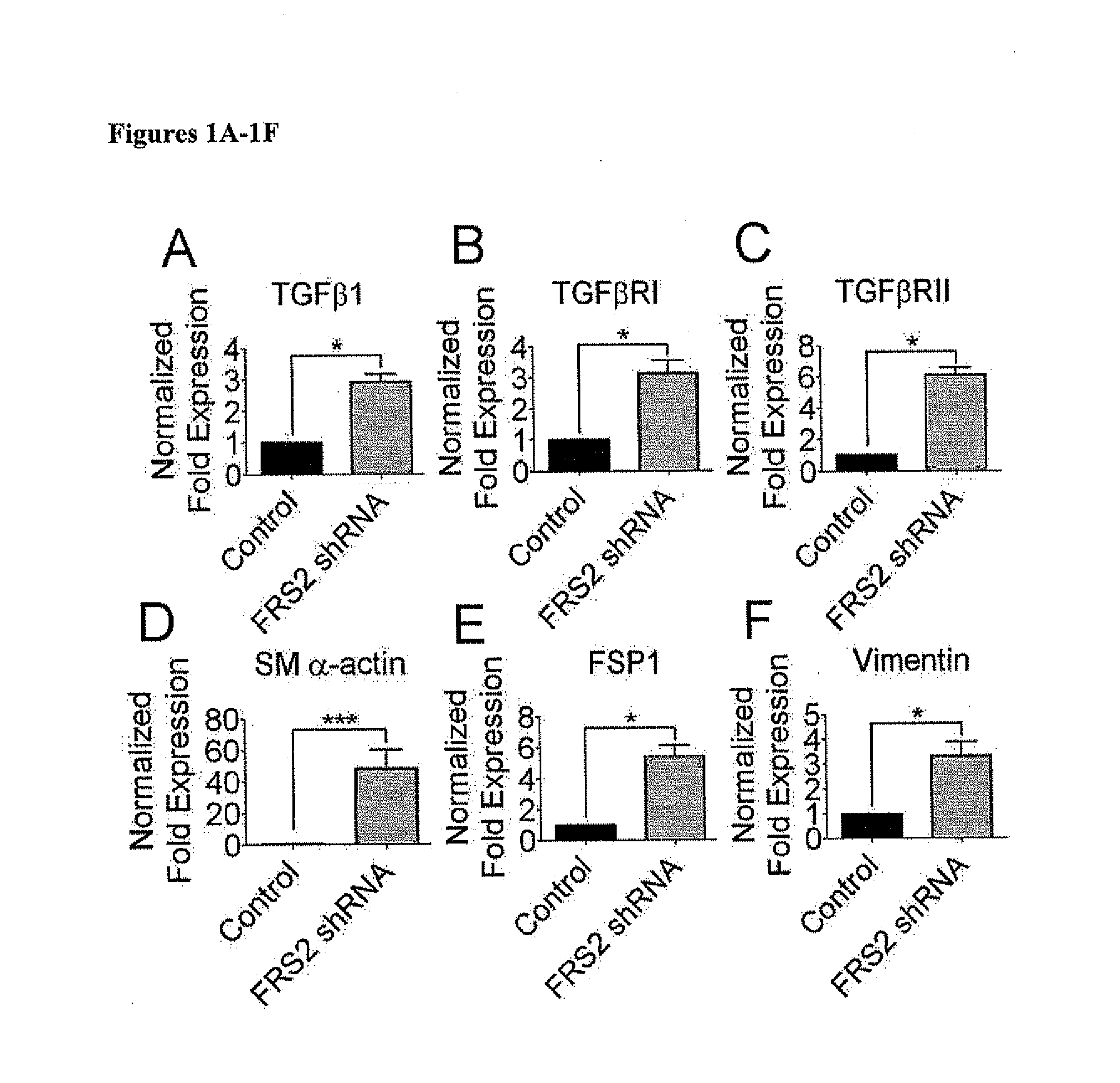 Compositions and Methods for Treating and Preventing Neointimal Stenosis