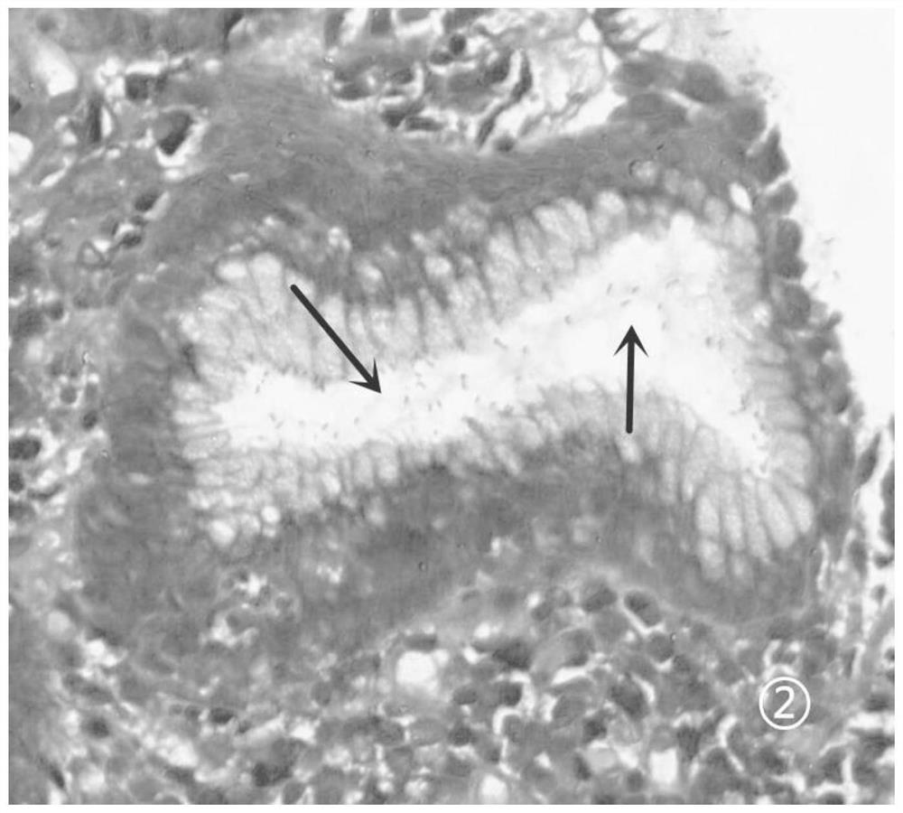 A kind of Helicobacter pylori staining liquid and staining method thereof