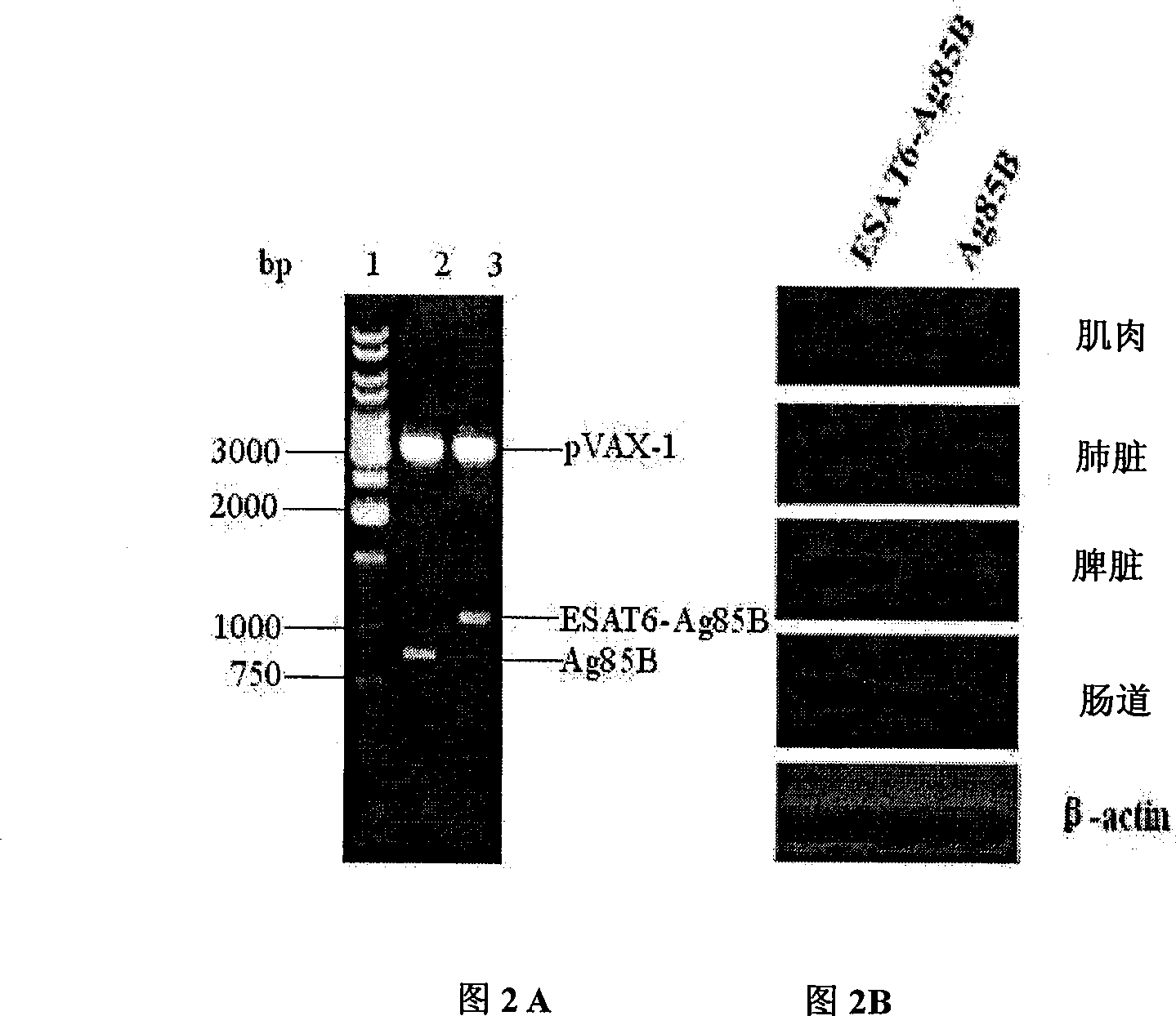 Attenuation bacteria carrier tuberculosis vaccine carrying tuberculosis, preparation method and application thereof