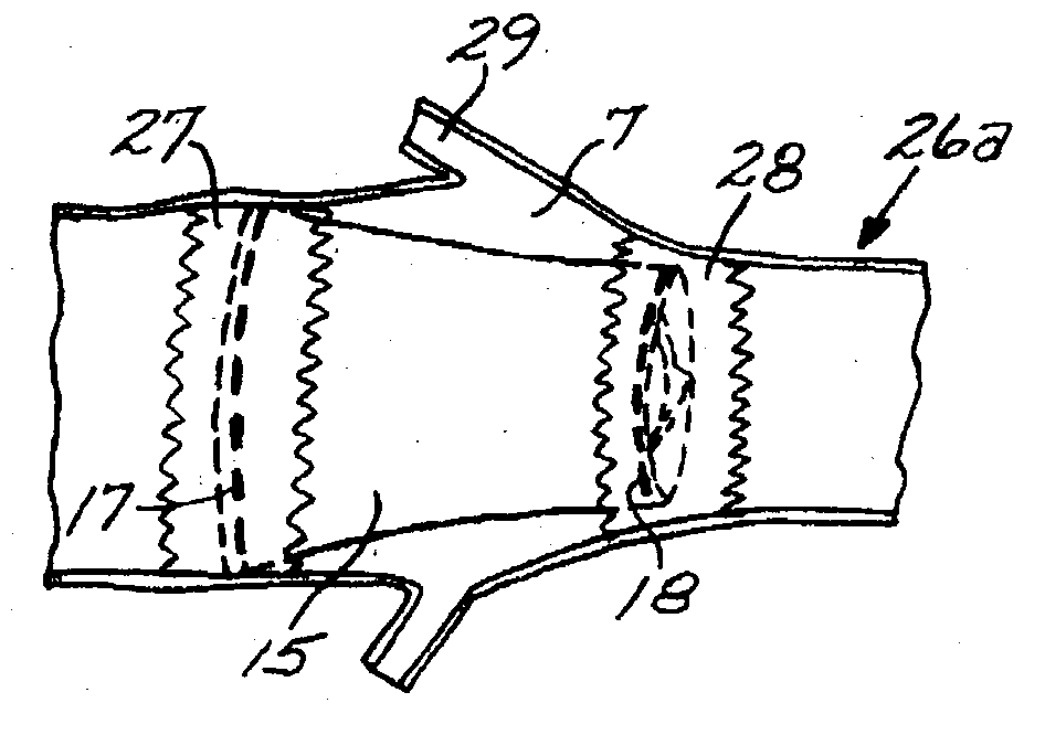 Sigmoid valve and method for its percutaneous implantation